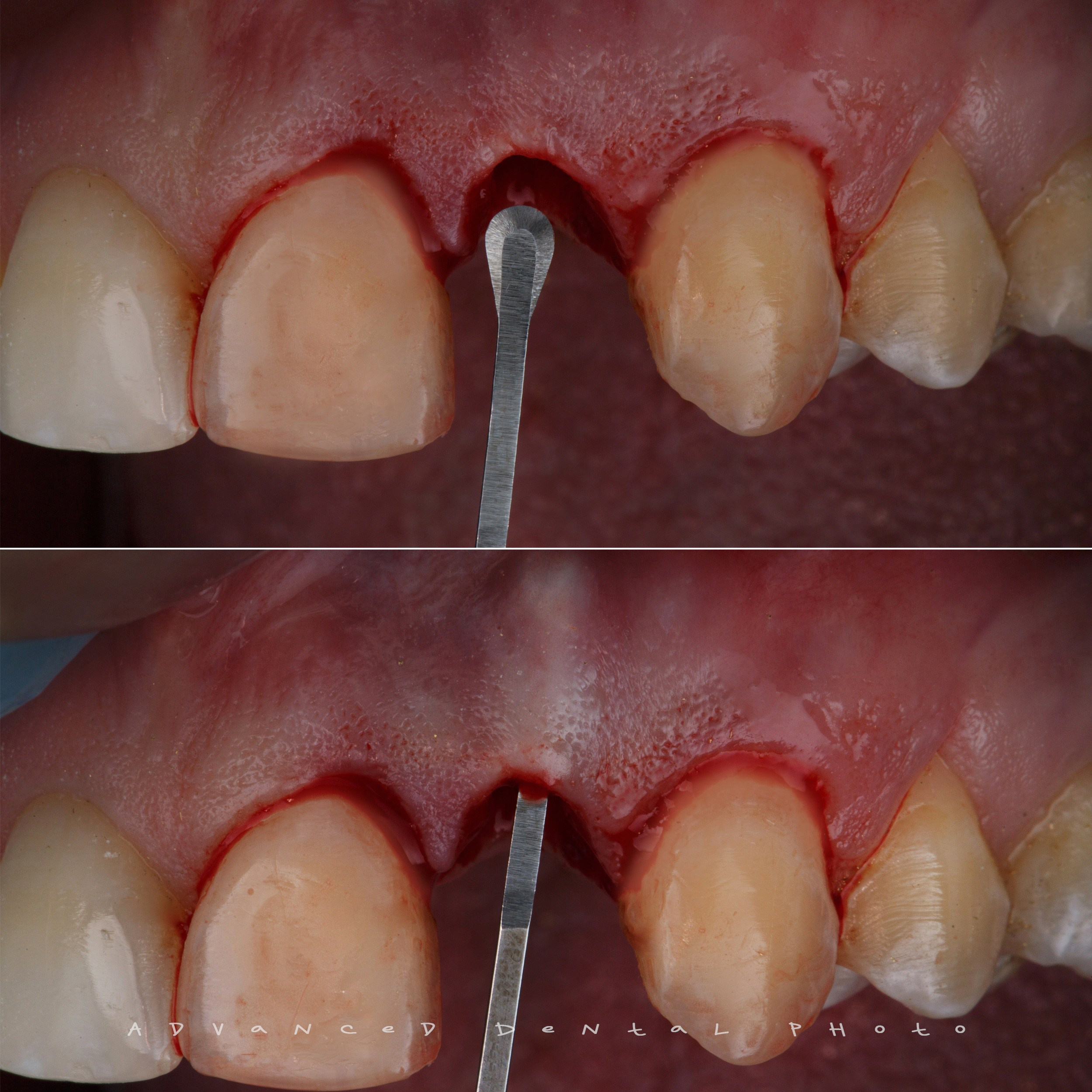 Хирургия. Дентал фотограф — видеограф Денис Дорошенко