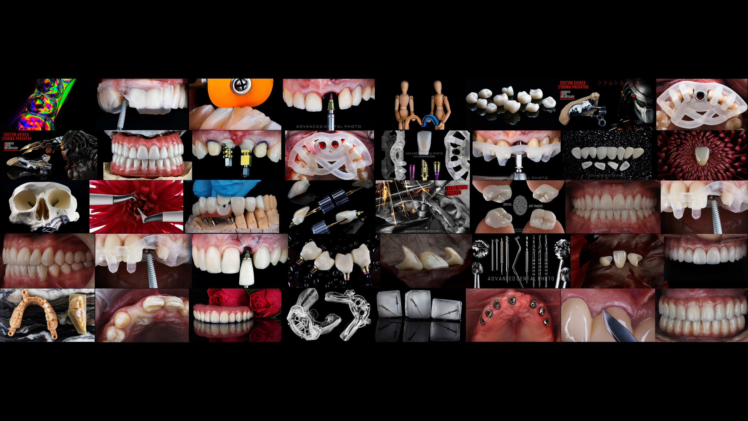 Дентал фотограф — видеограф Денис Дорошенко