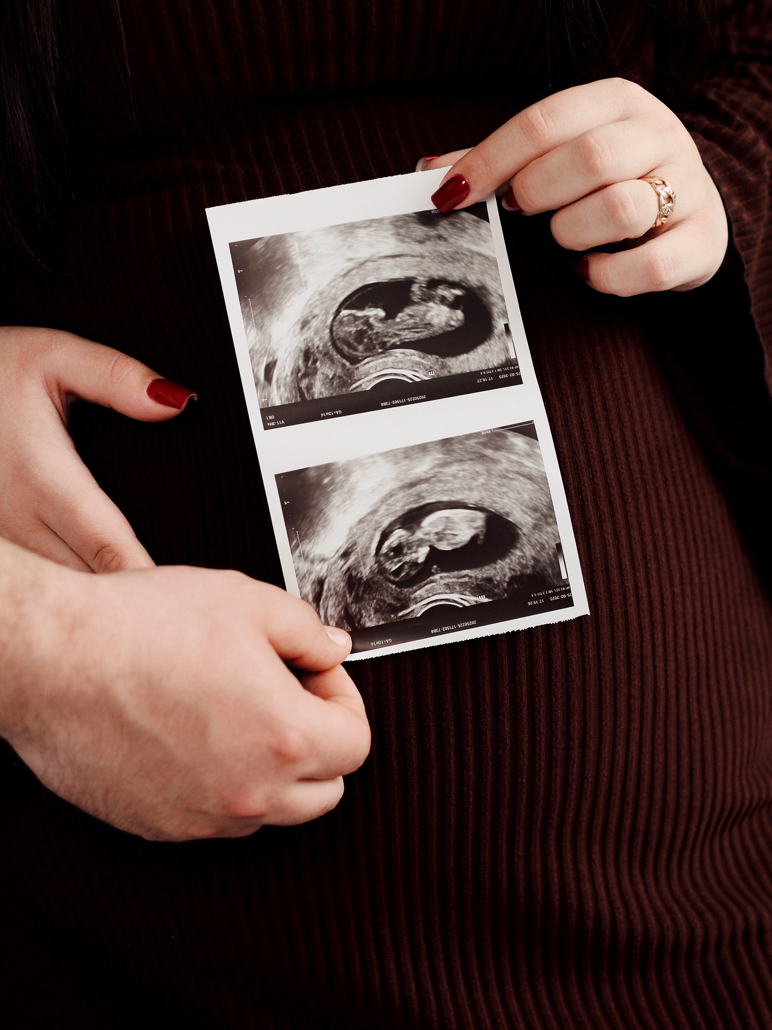 Love story. Photography Eva