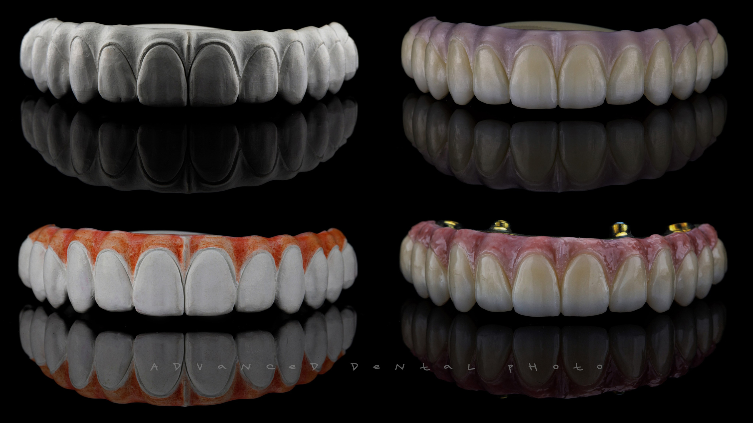 Дентал фотограф — видеограф Денис Дорошенко