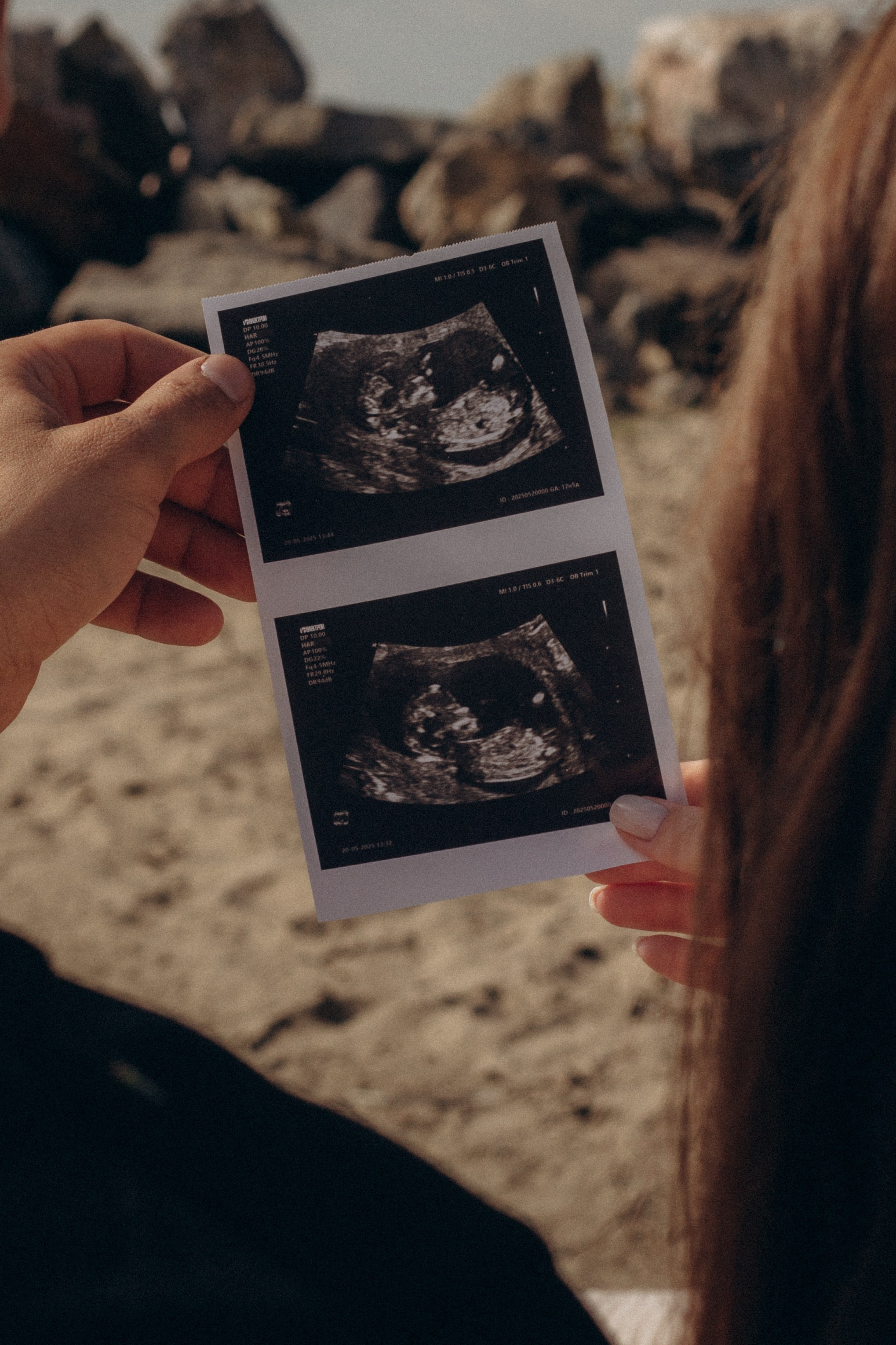 Идеи для фотосессии беременных с мужем