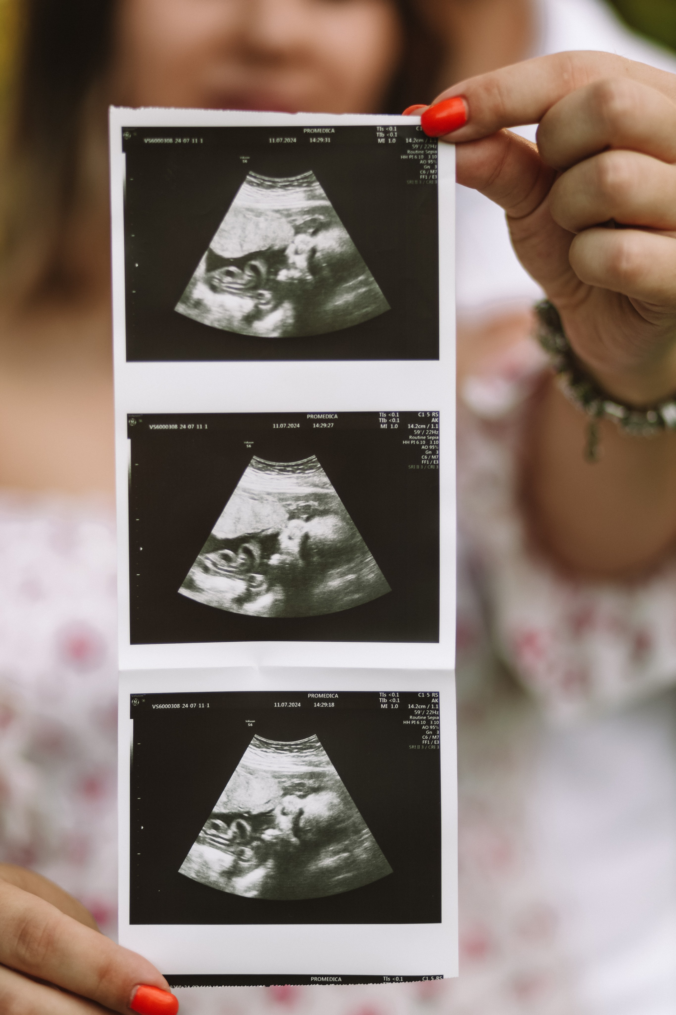 Таня и Рома. О фотографии с душой