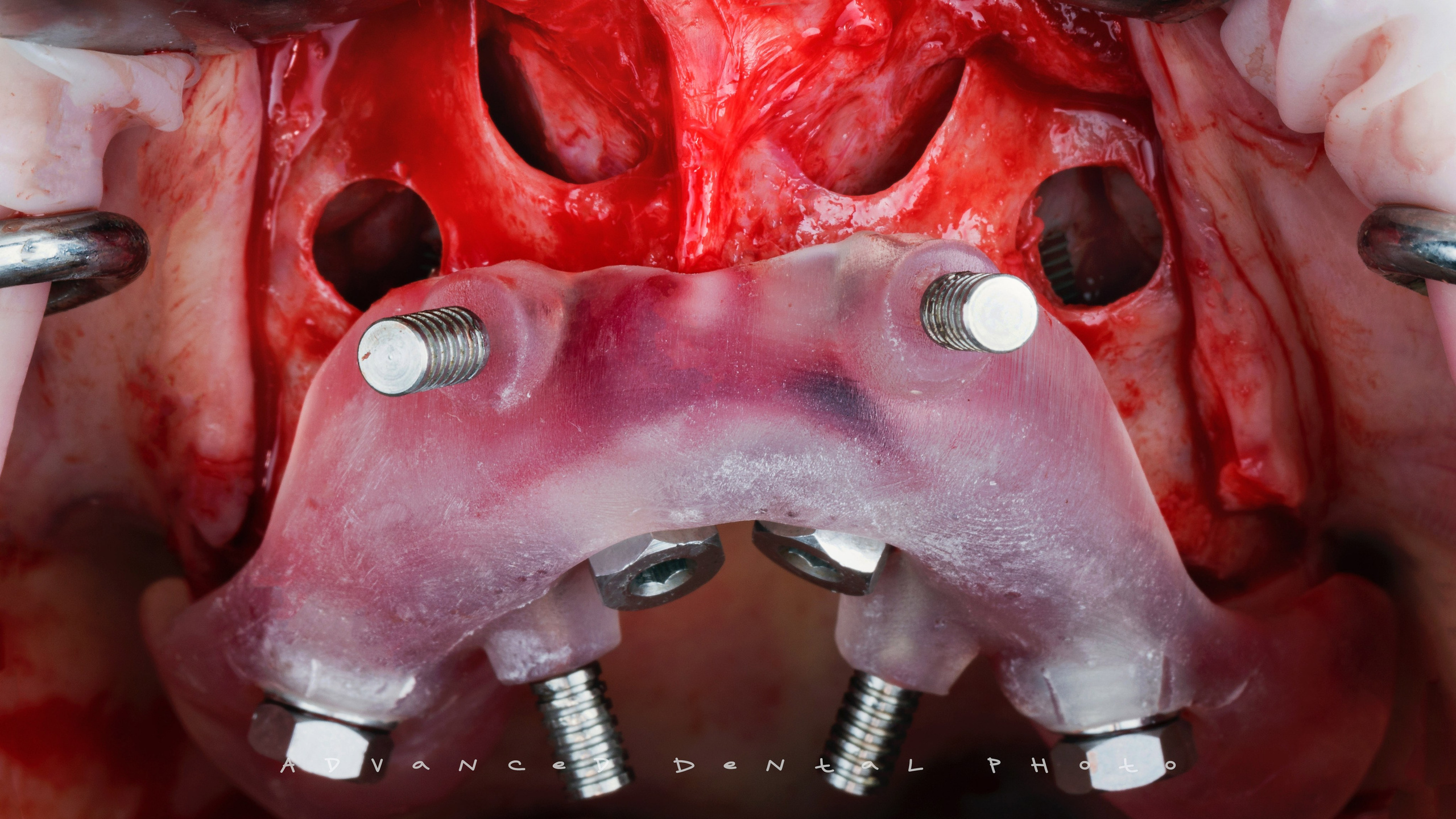 Хирургия. Дентал фотограф — видеограф Денис Дорошенко