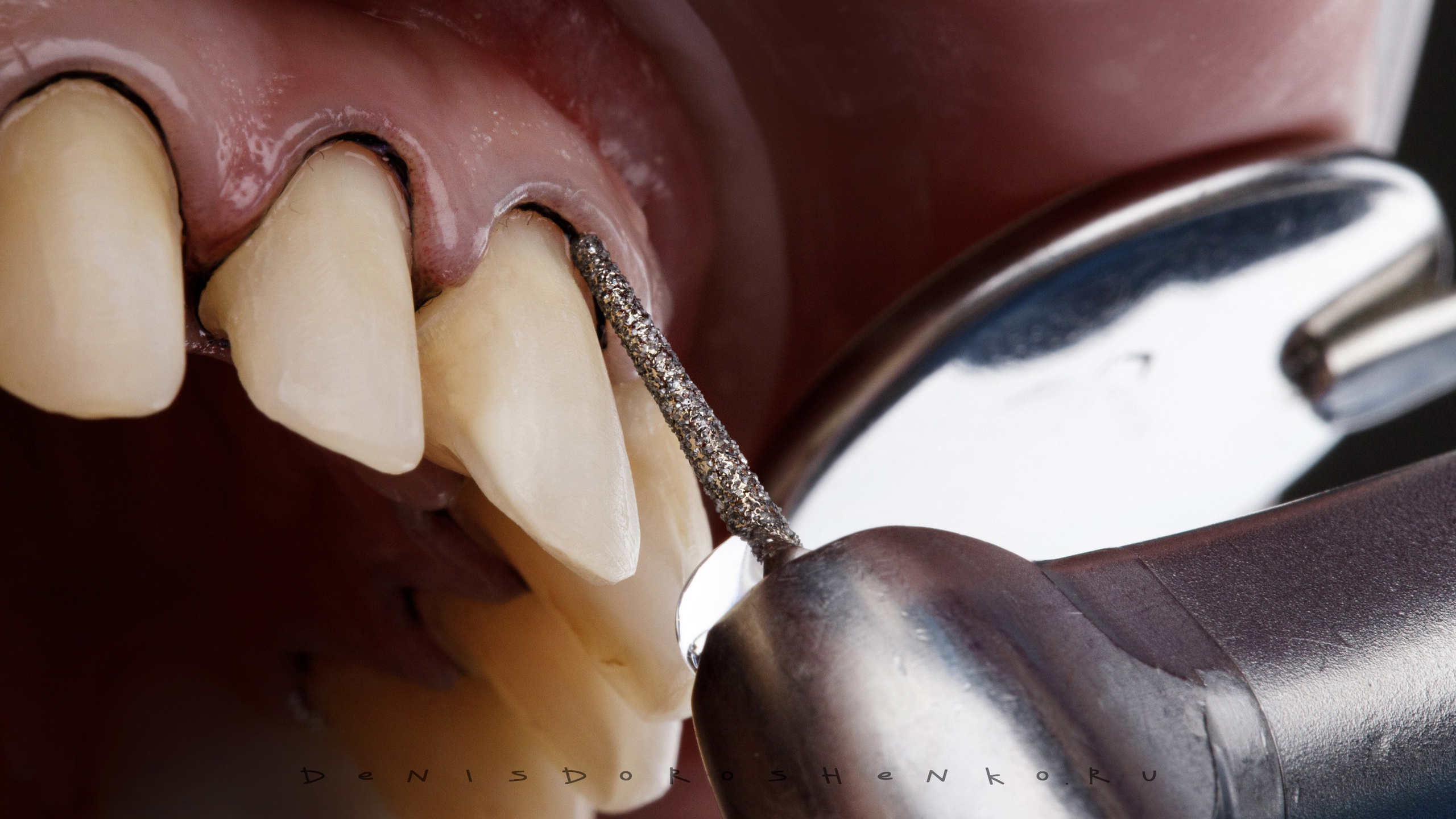Ортопедия. Дентал фотограф — видеограф Денис Дорошенко