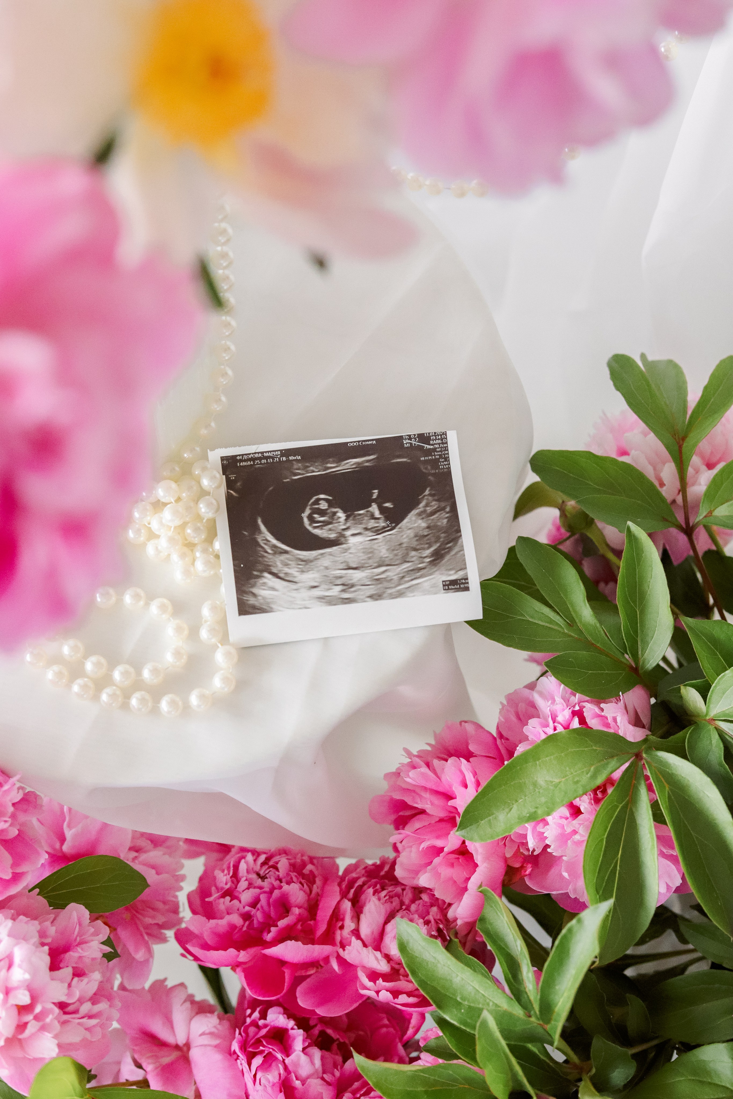 Беременность. Kate Bunny | фотограф и видеограф в Люберцах