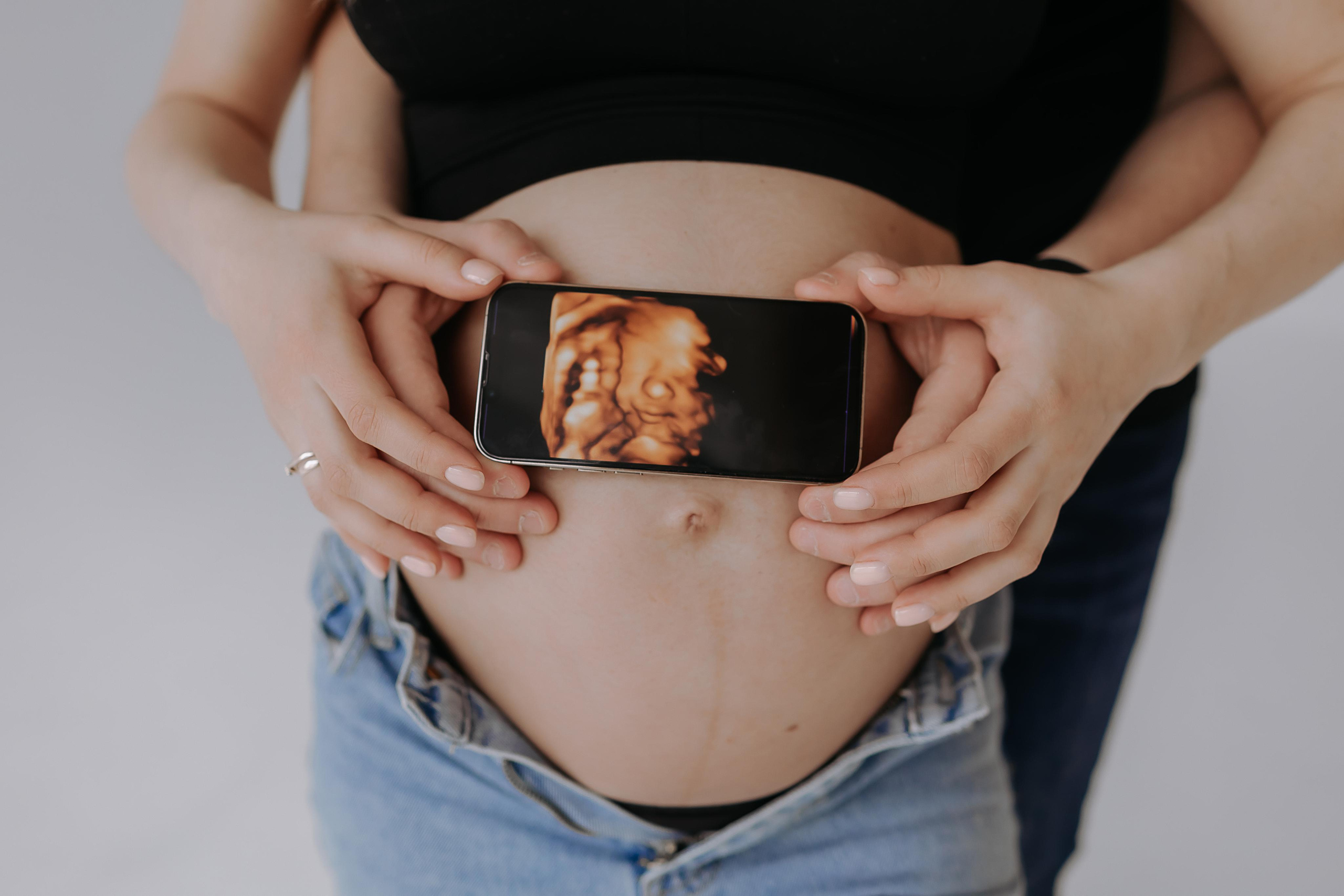 Элла и Илья. Свадебный фотограф | Москва | Демидова Мария