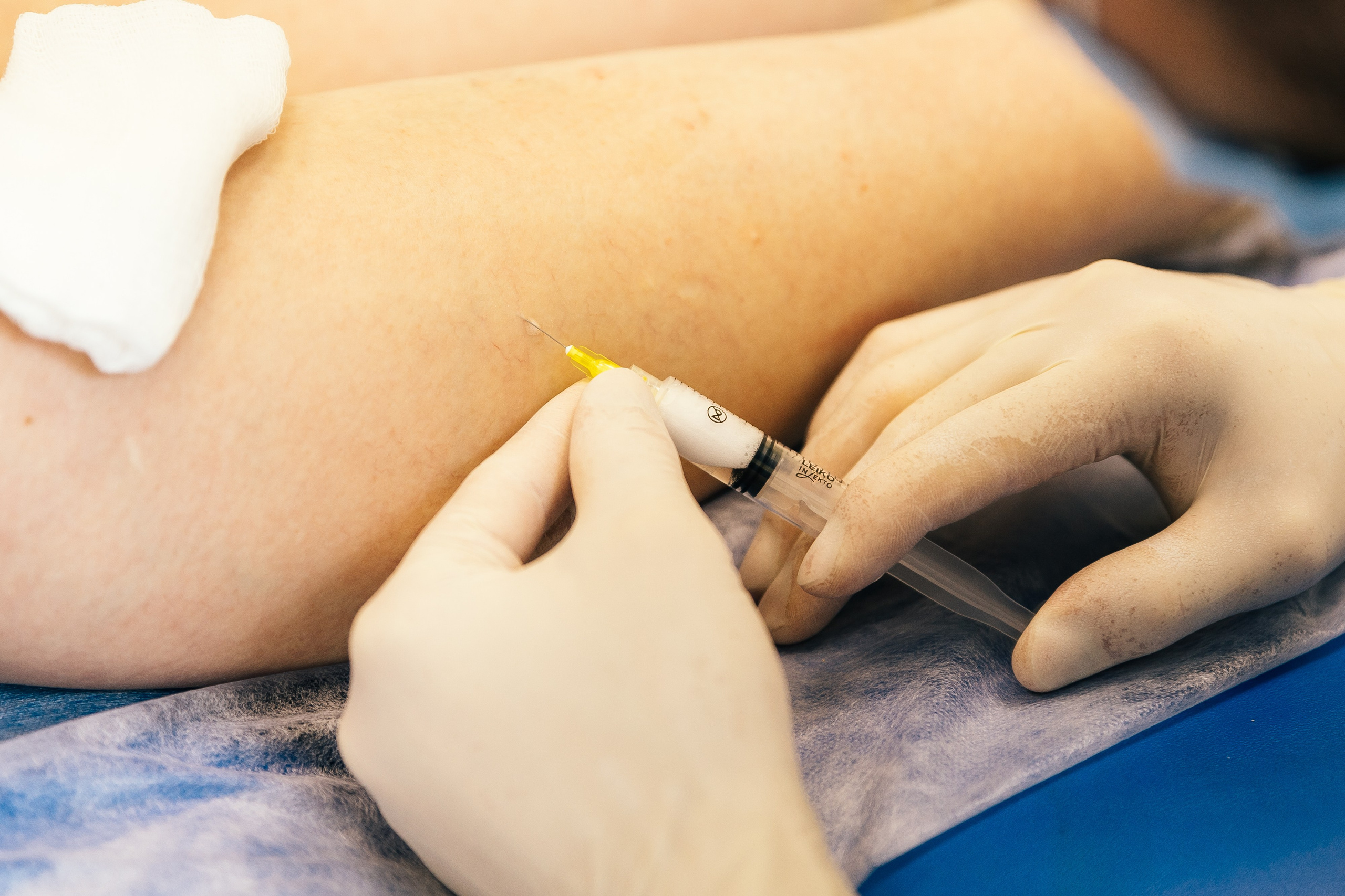 Клиника Варикоза нет. Ваш самый лучший фотограф!