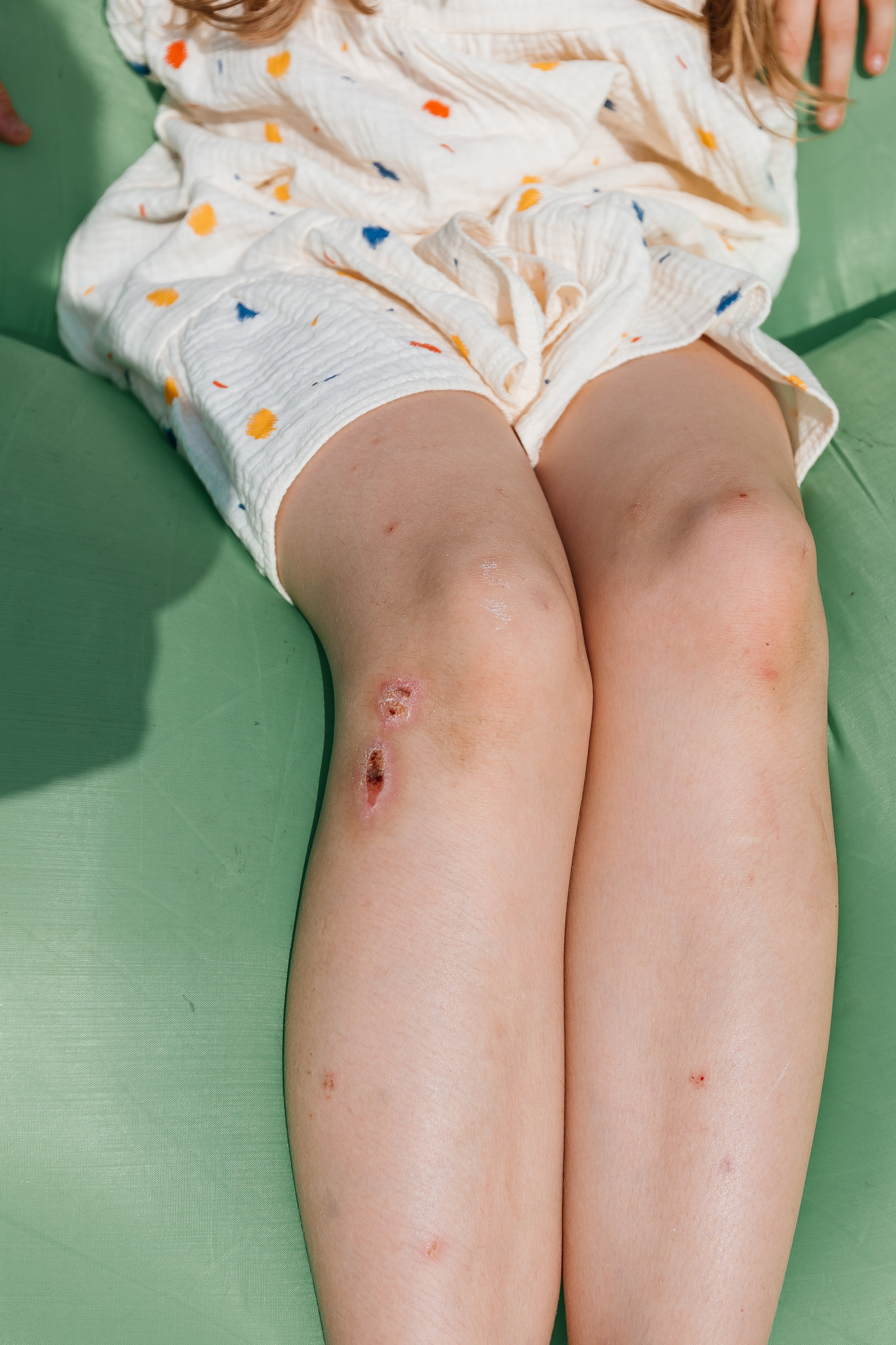 Дачный вопрос. Семейный LIFESTYLE фотограф в Москве