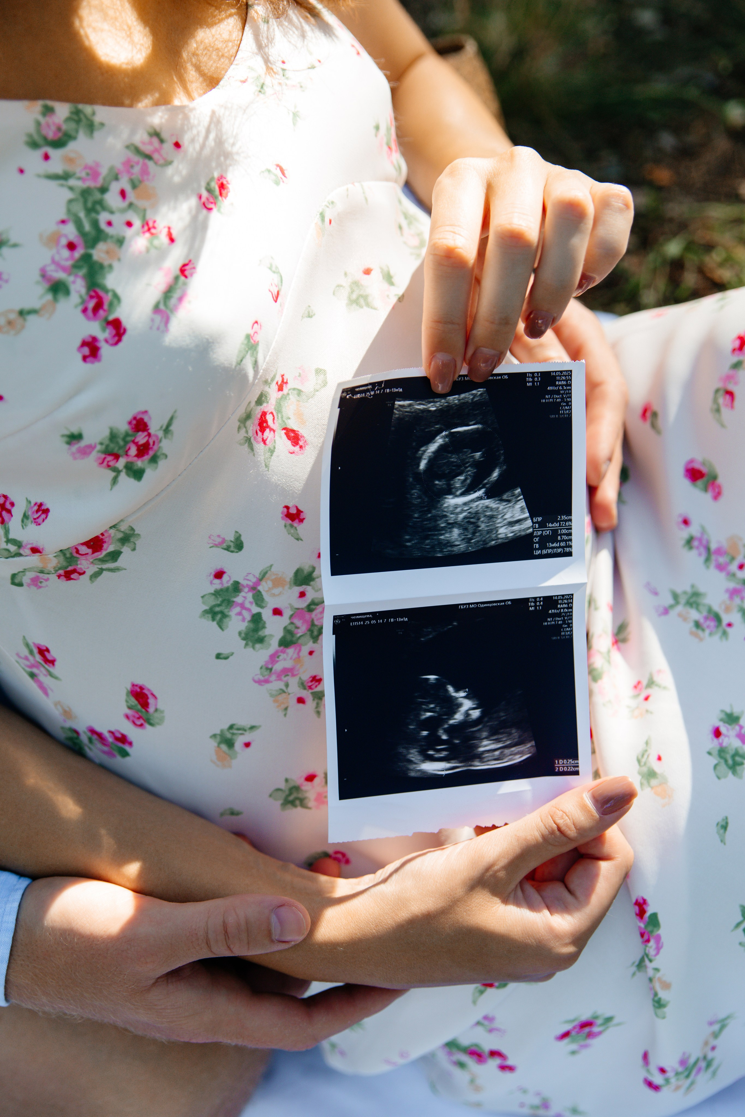Фотосессия беременности. Фотограф в городе Лыткарино Волкова Ольга