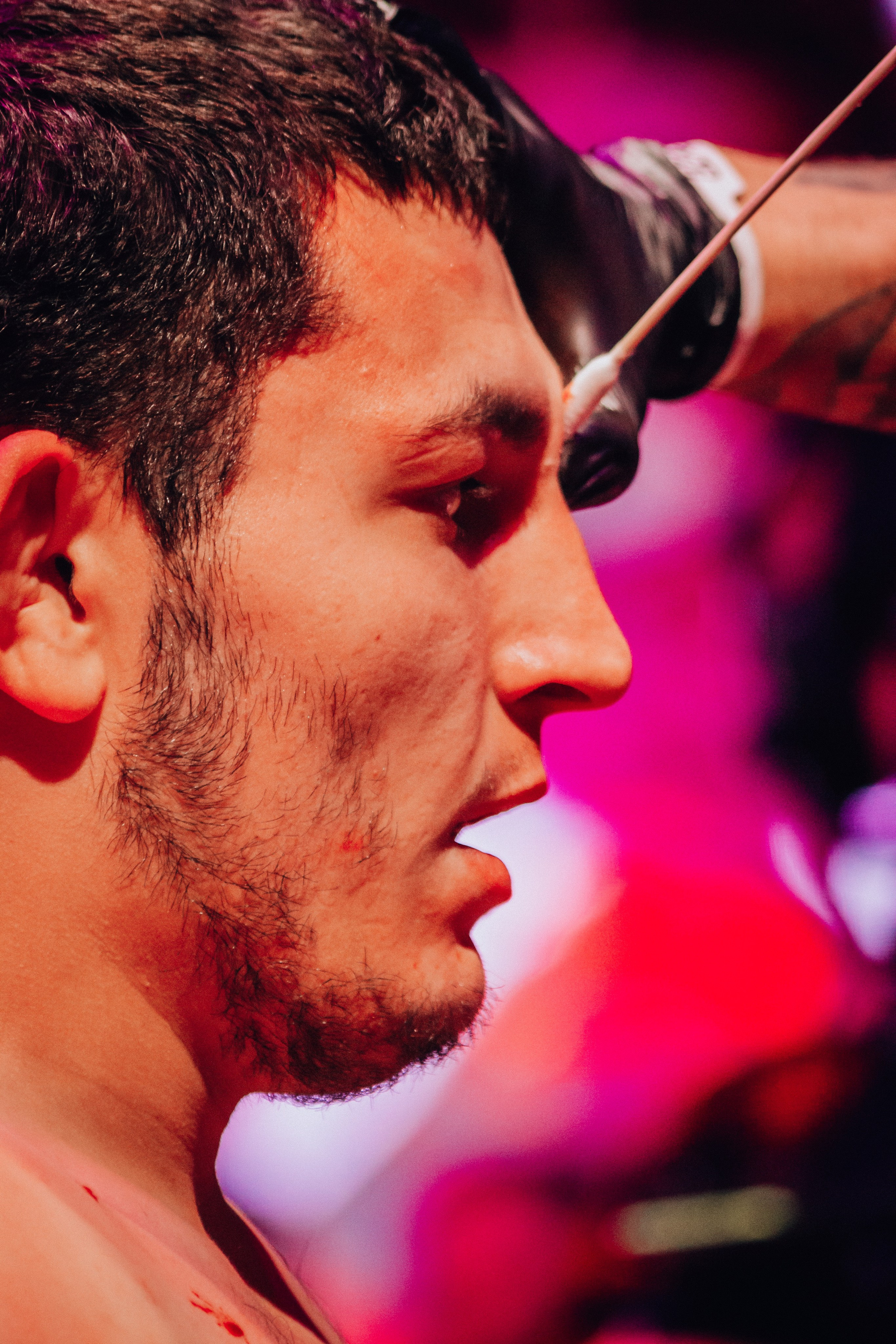 Кулачные бои TopDog. Анастасия Тен