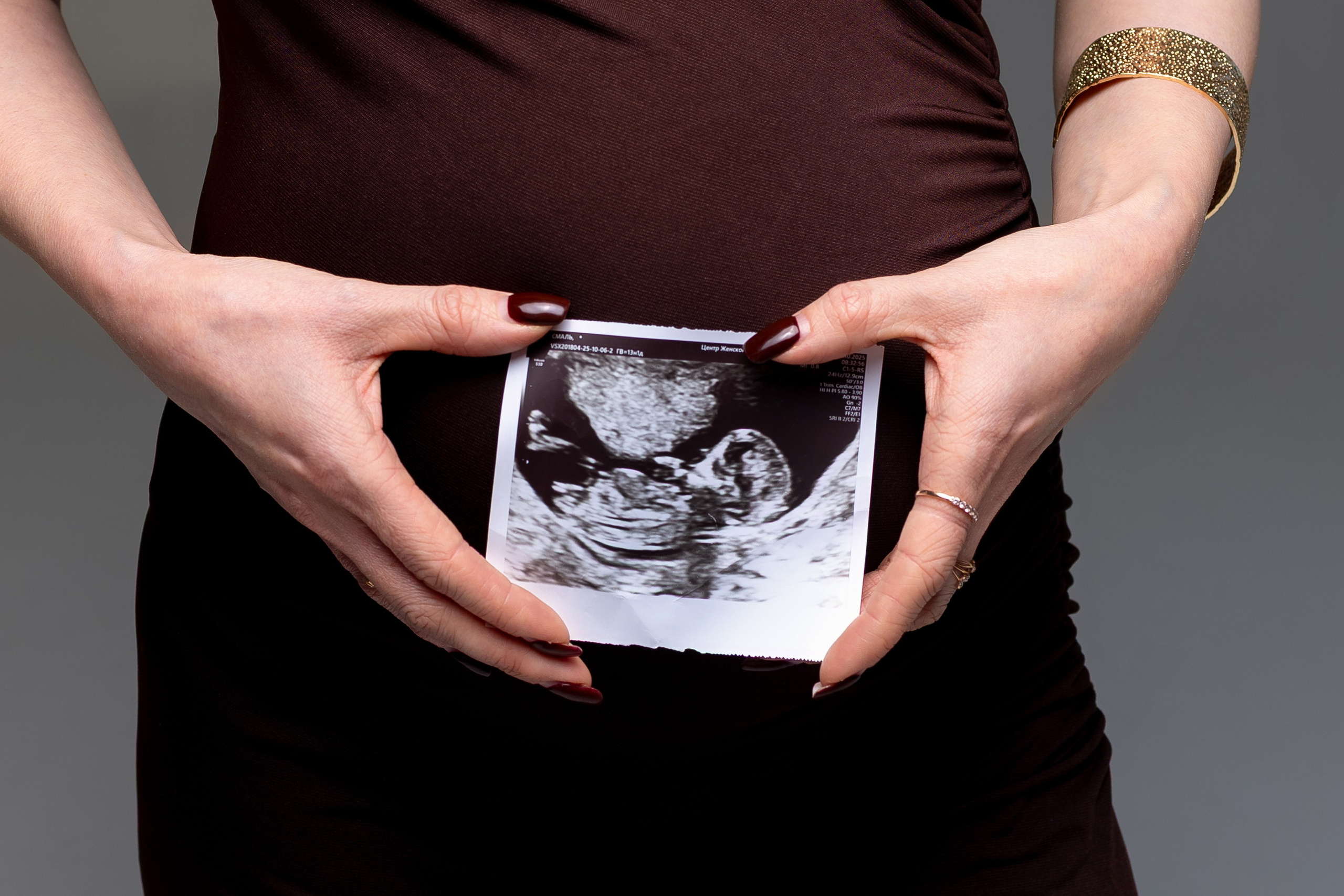 Вероника, классическая портретная фотосессия беременности в студии. Семейный фотограф в Москве Марина Петра