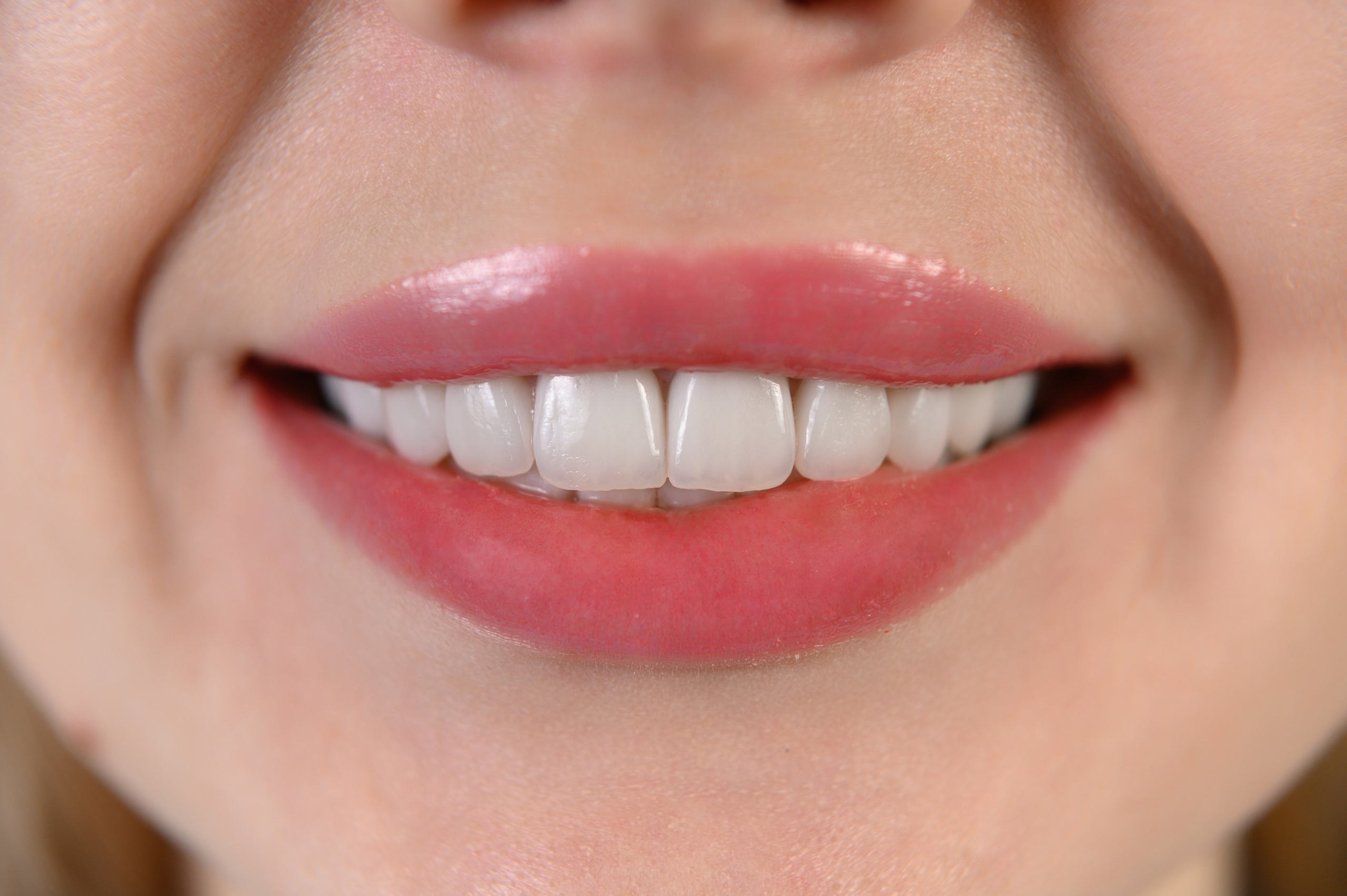 Профессиональная фото и видео съемка стоматологии. Виниры