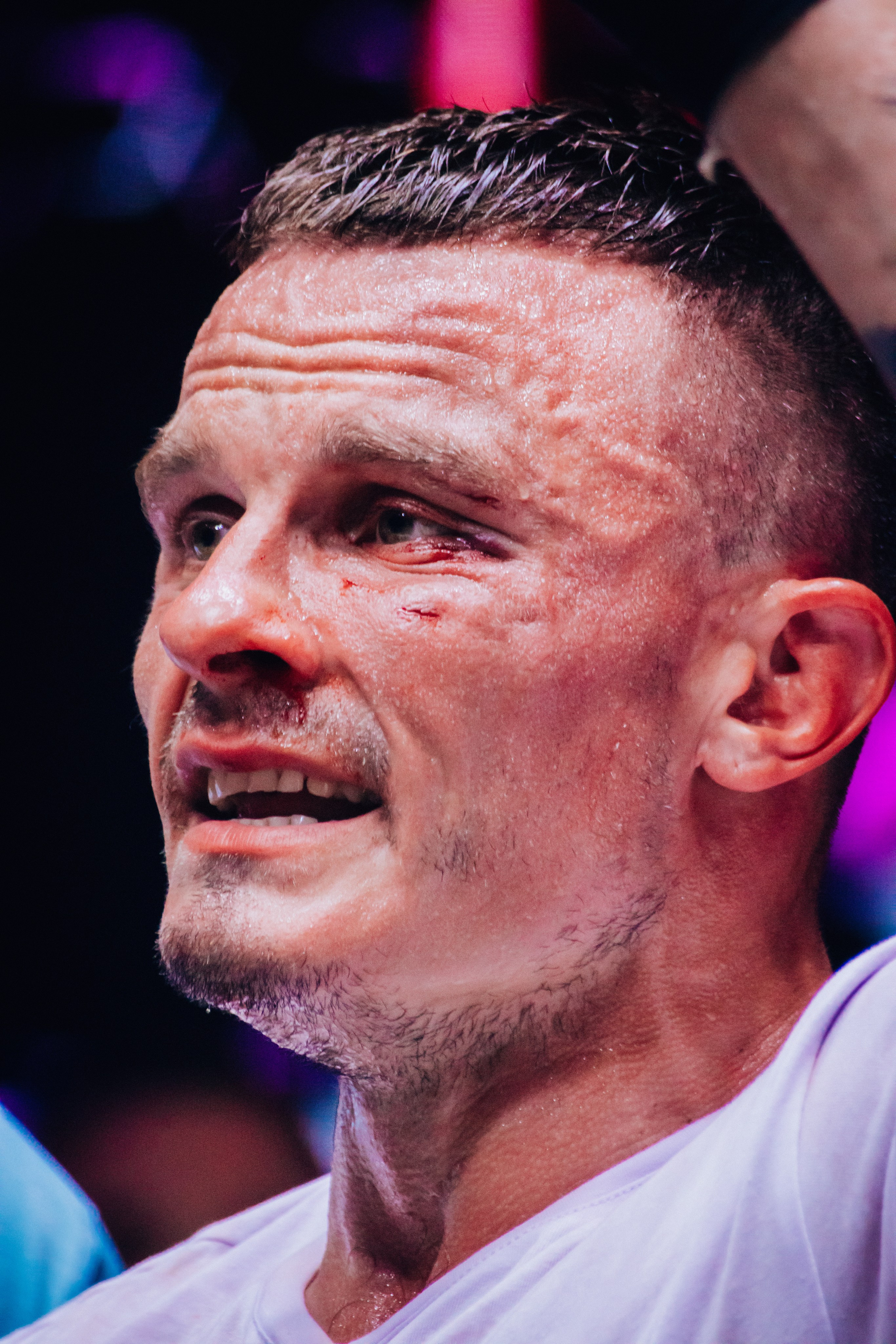 Кулачные бои TopDog. Анастасия Тен