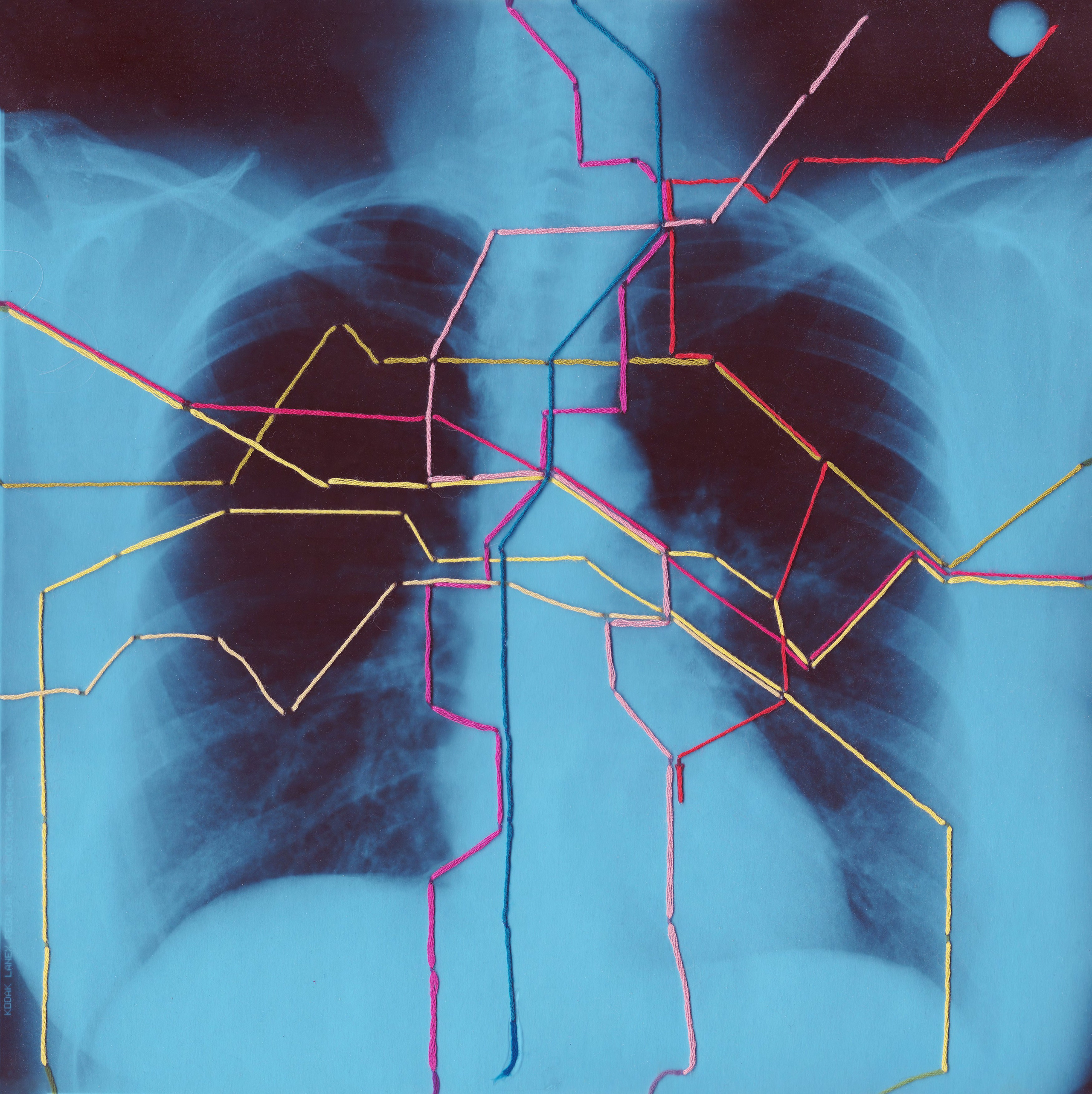 ANALOG COLLAGE. Анна Ульянова