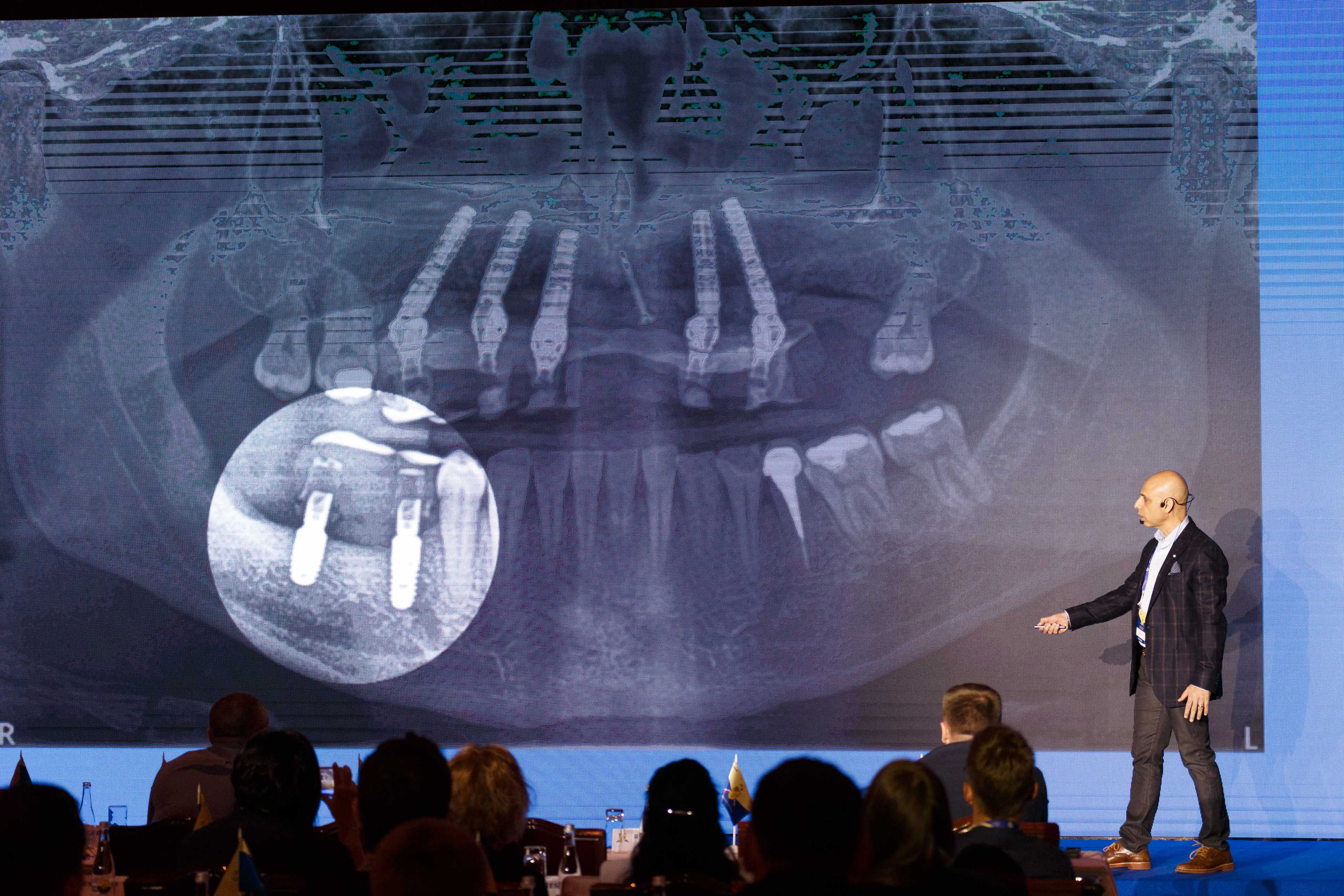 Bredent Group Days. TVSPhoto — Visual content production