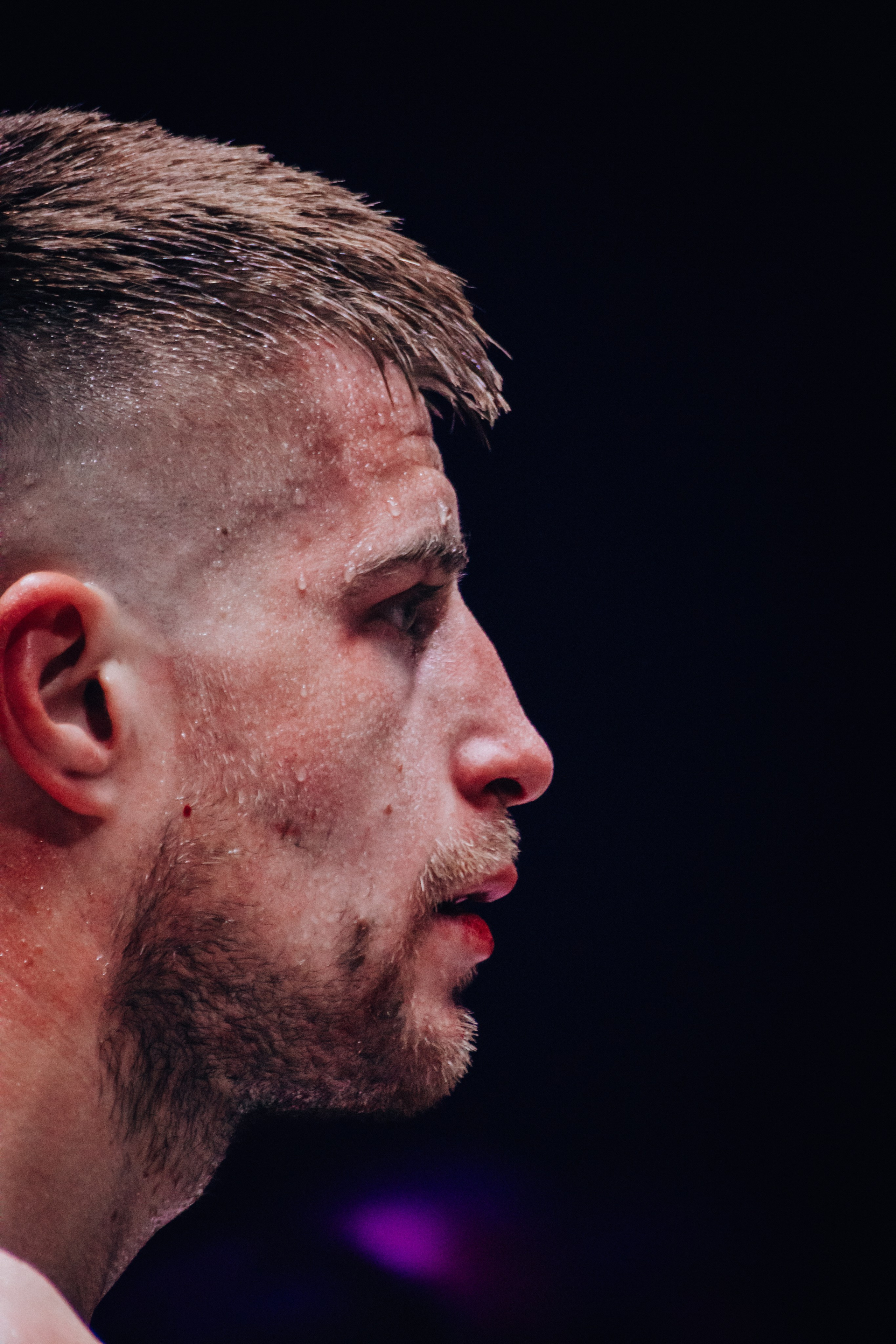 Кулачные бои TopDog. Анастасия Тен