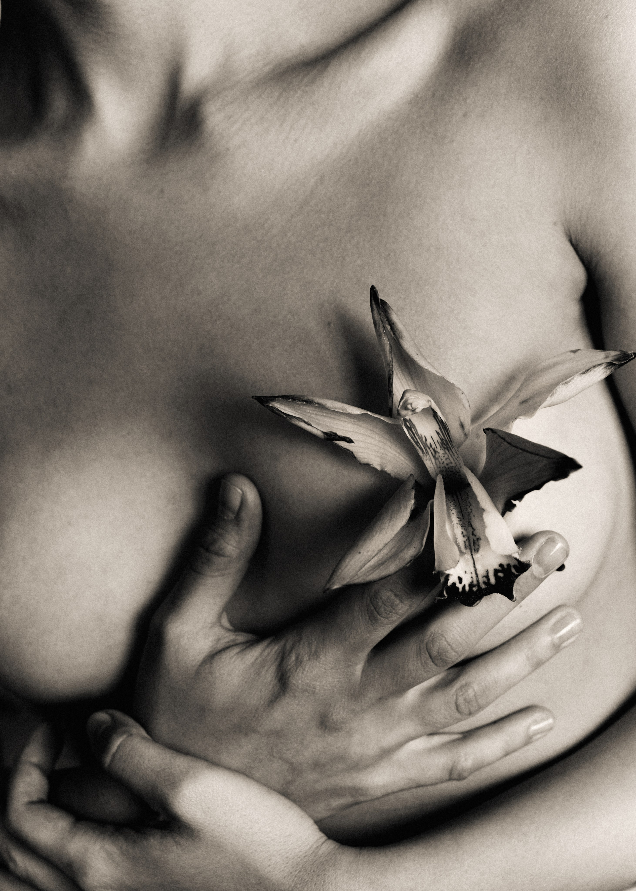 Other. DISEMICHASNOVA