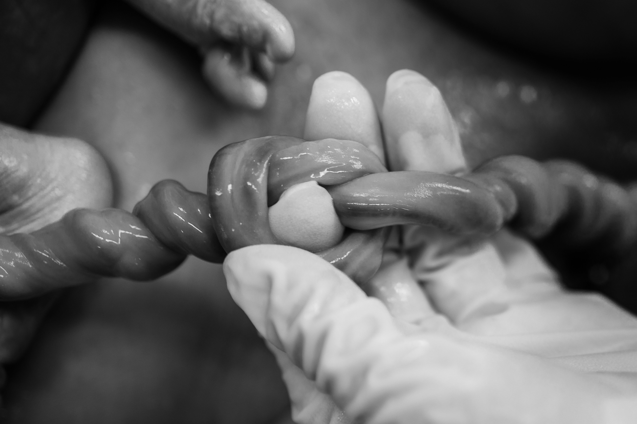 Фотография в родах