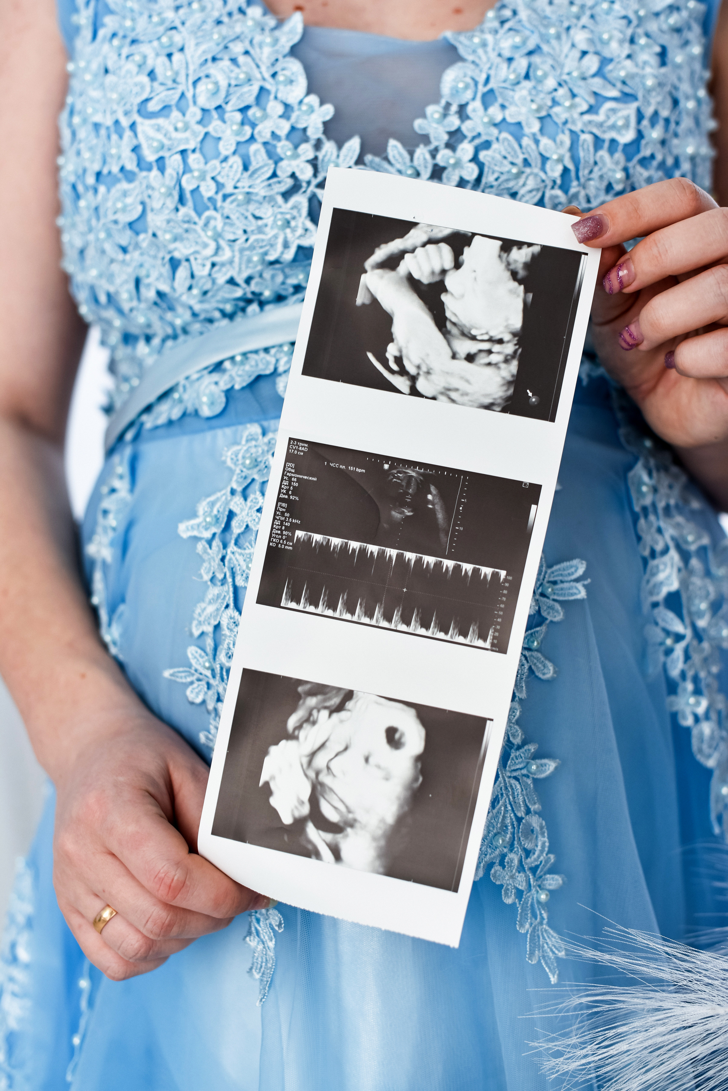 Анна и Сергей