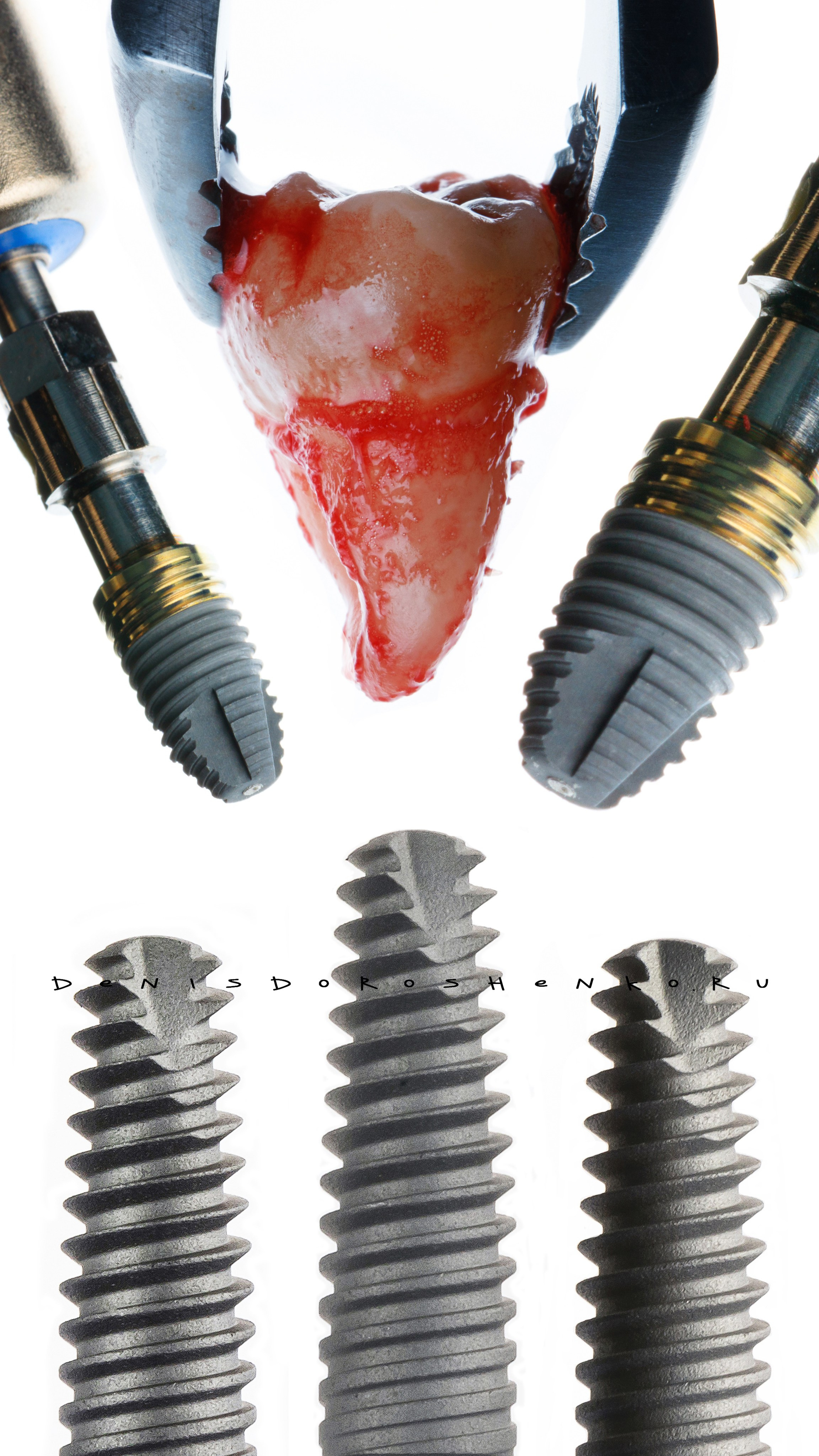 Хирургия. Дентал фотограф — видеограф Денис Дорошенко