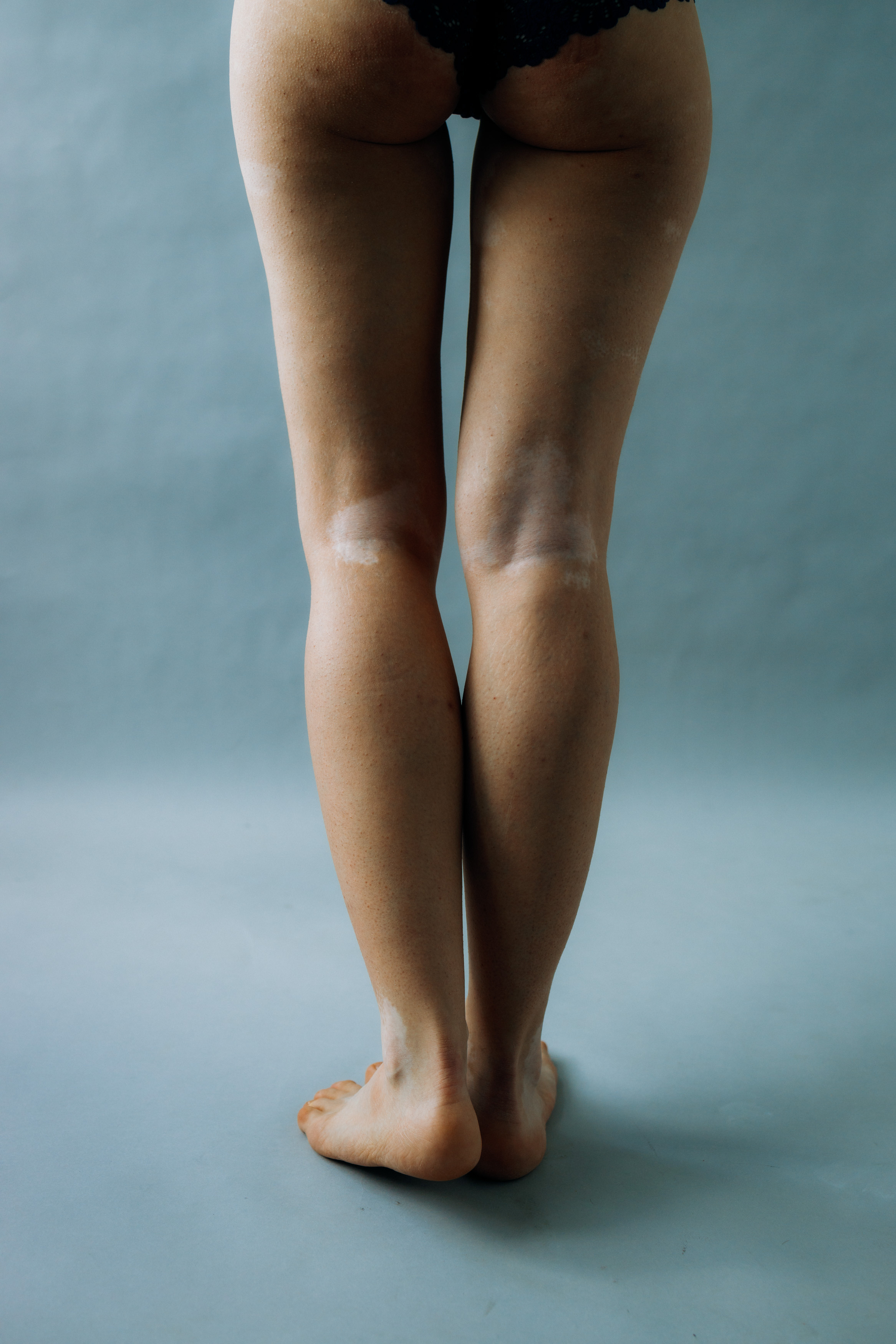 Аня. Фотограф Фототерапевт Минск