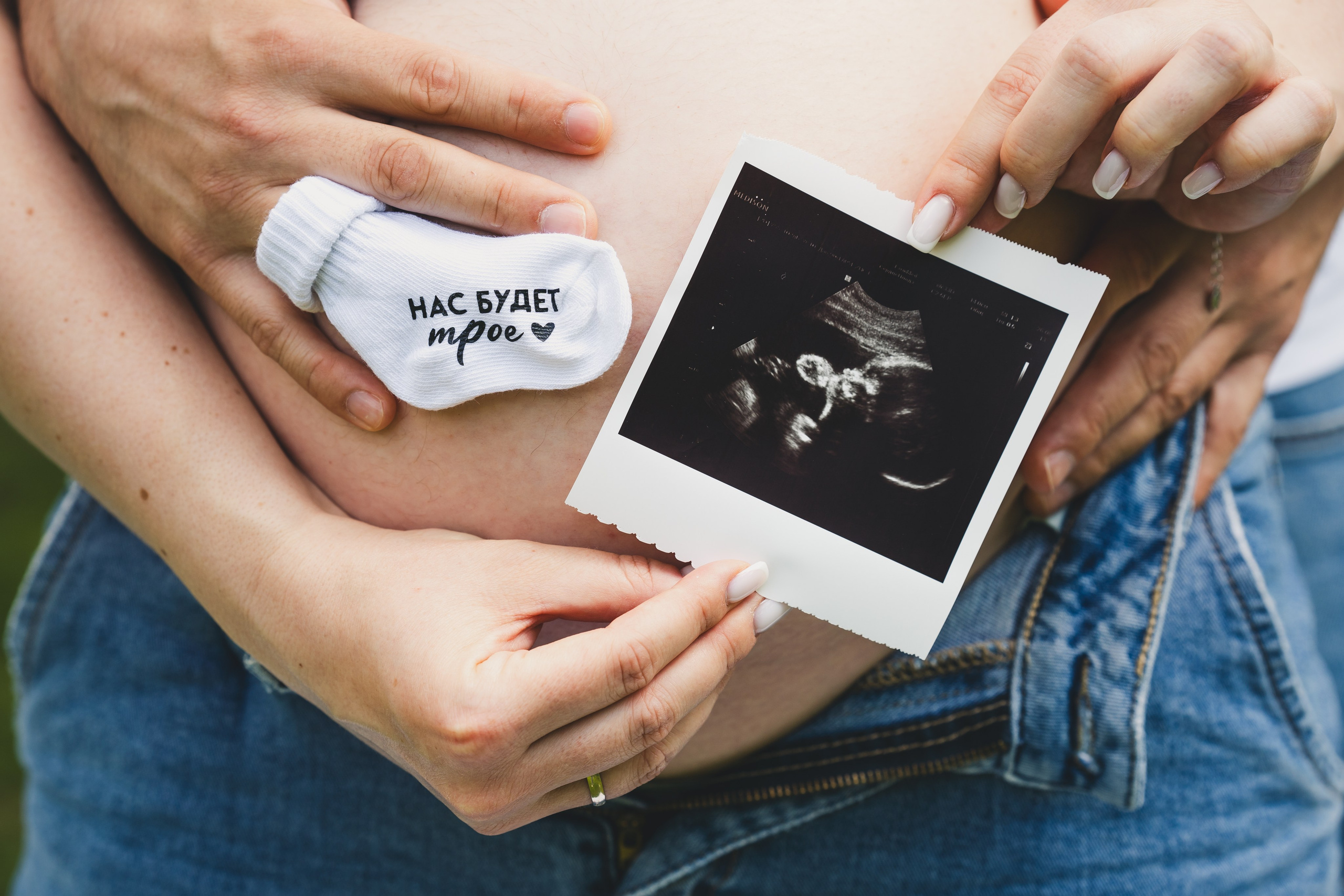 Гендер-пати на природе. Репортажный фотограф в Москве Легкая Софья