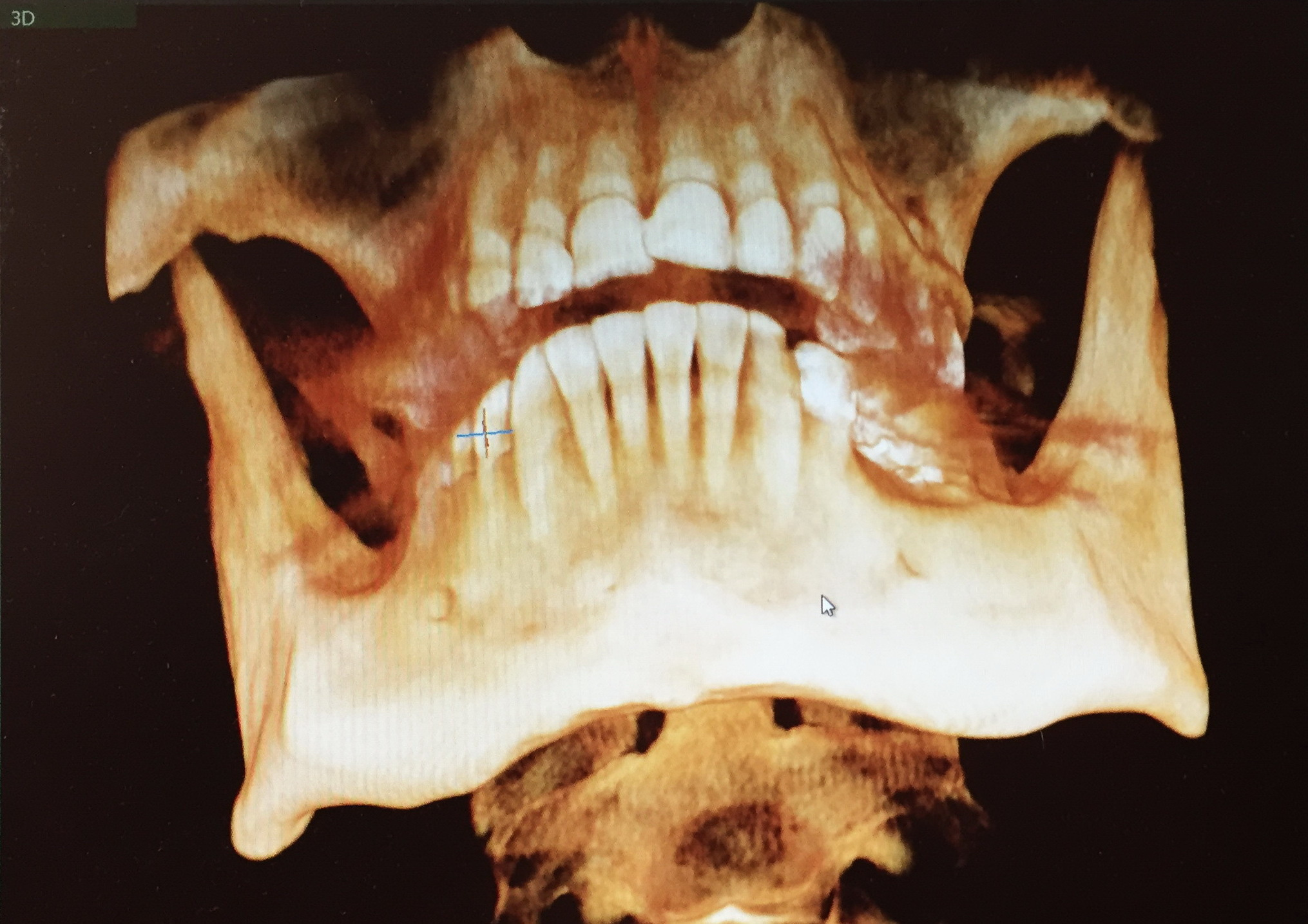 Василиса Моисеева -  выставка ''Вещь № 4'' с 26 августа по 26 октября