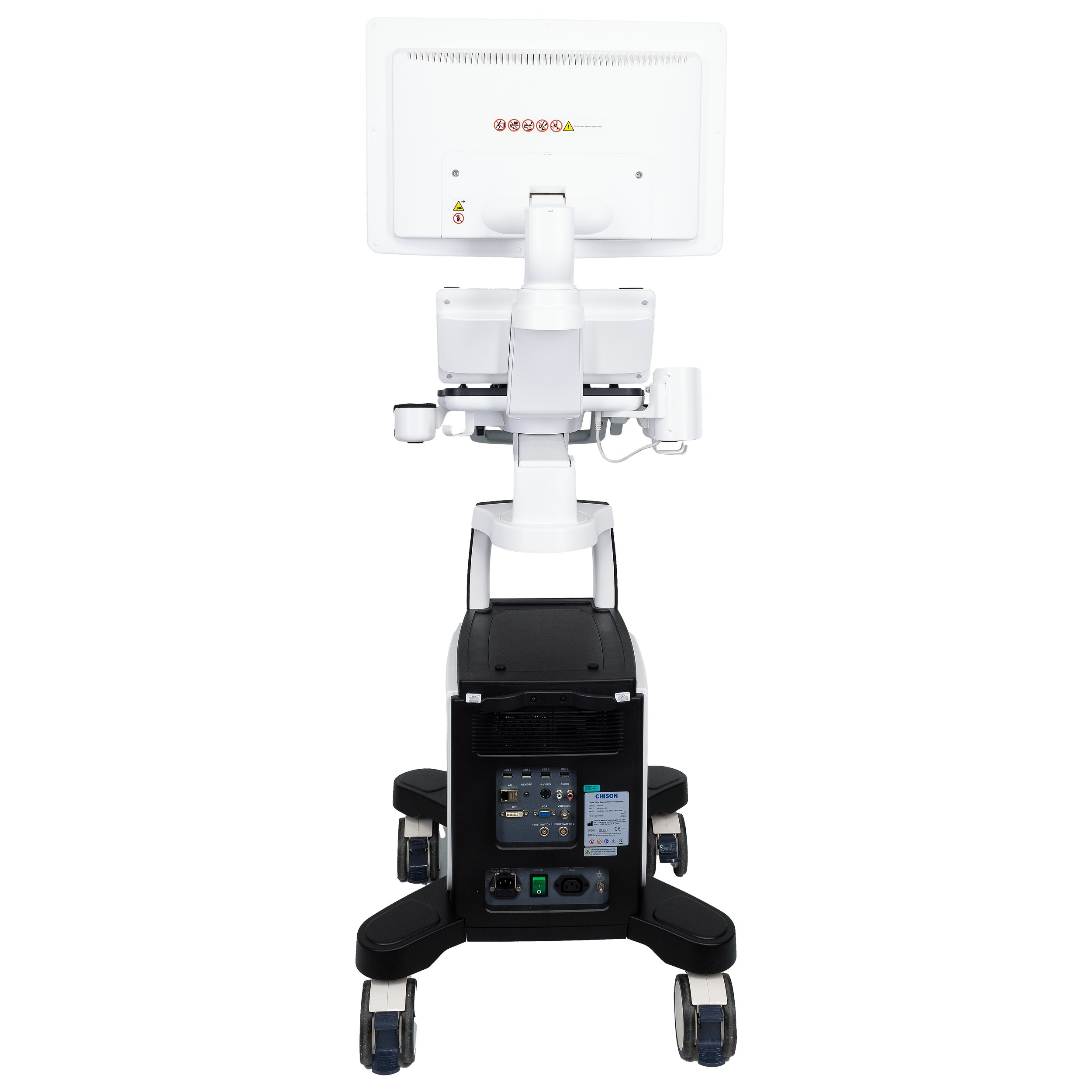 Аппарат УЗИ вид сзади