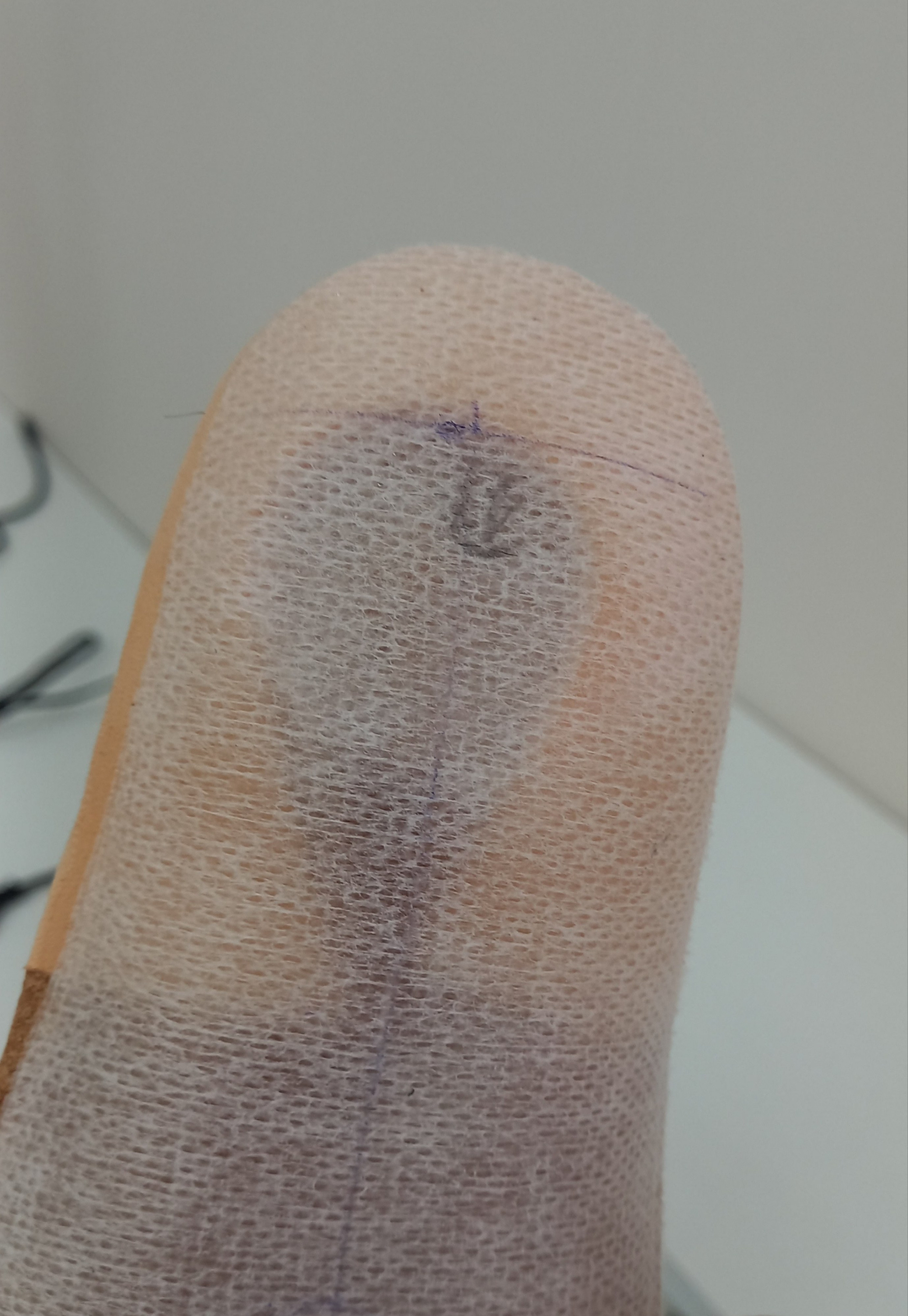 Индивидуальная ортопедическая стелька при пяточной шпоре. Подолог г. Хабаровск — центр здоровой стопы «FOOTTIME»