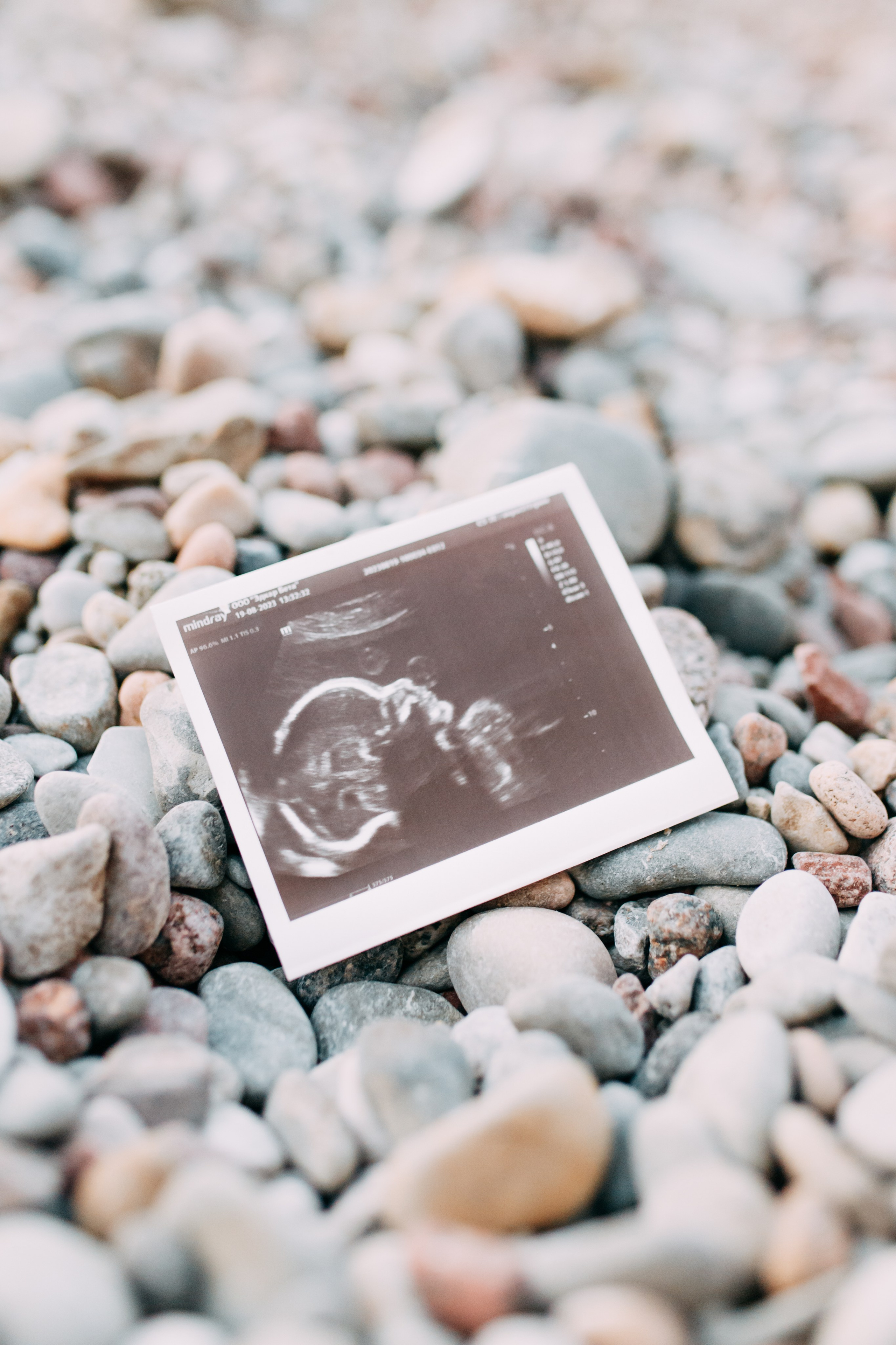 1 + 1 = 3 • Осень 2023. Фотограф в Калининграде Екатерина Осинцева