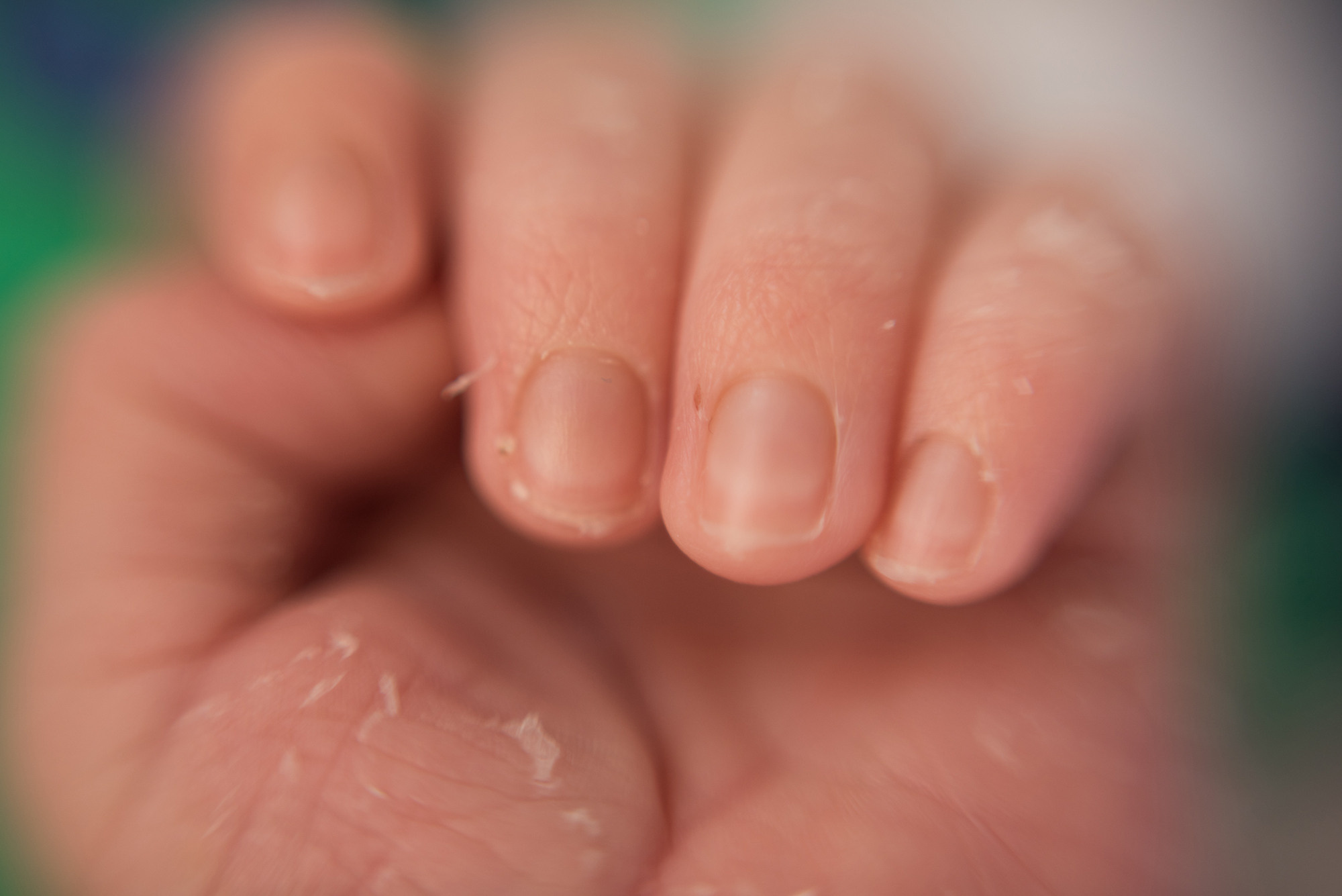 Ален 10 дней