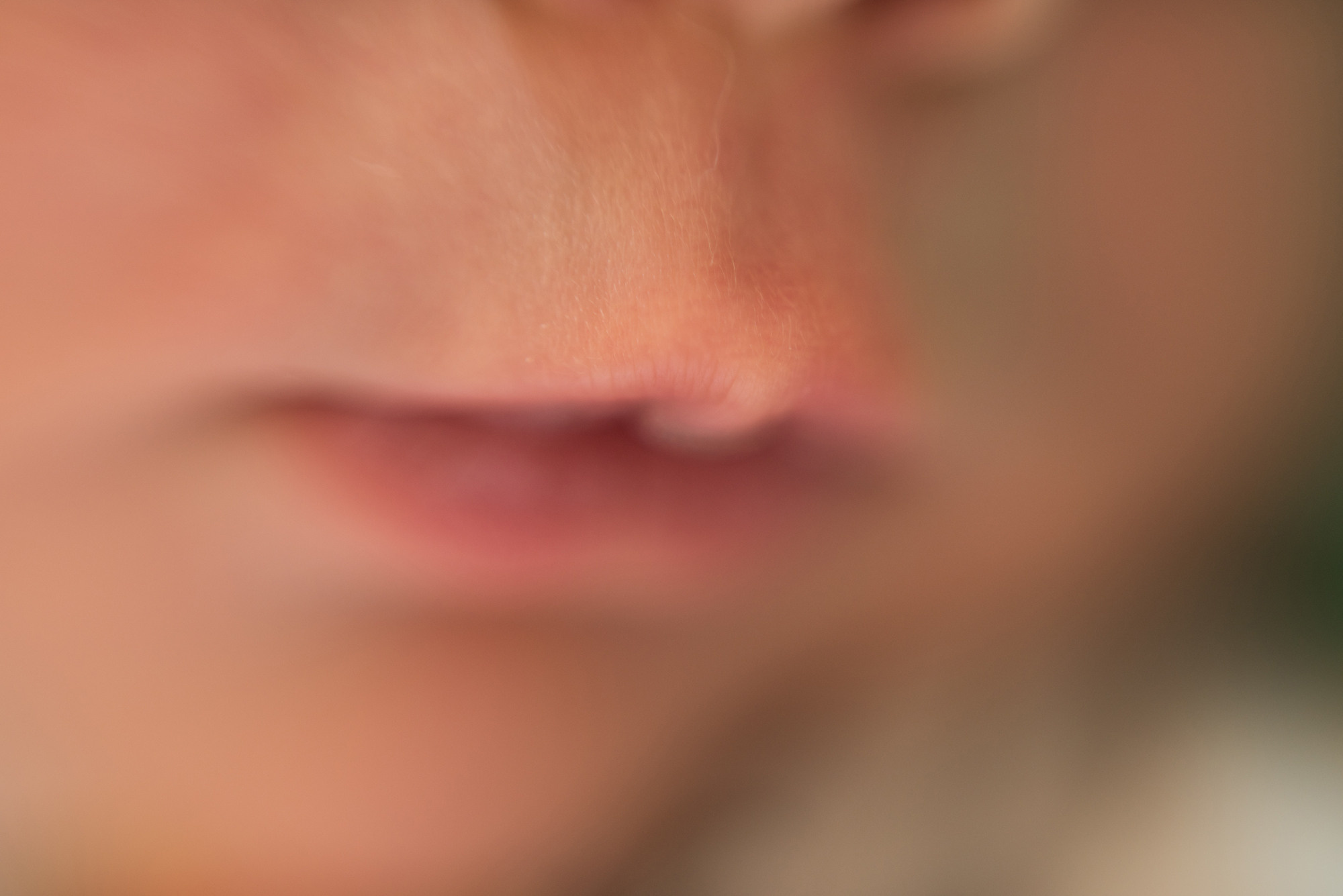 Ален 10 дней