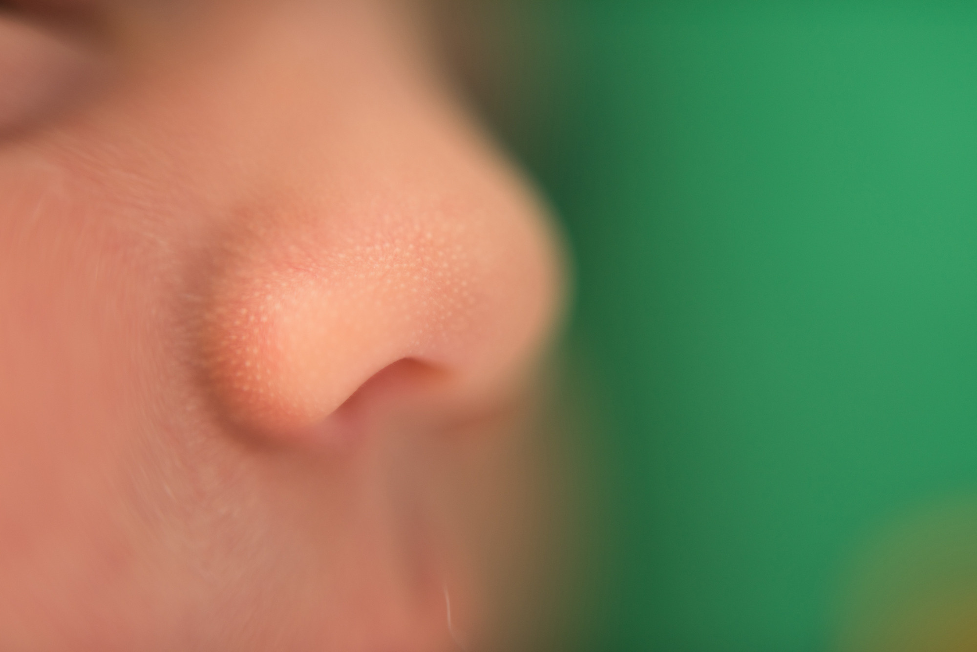 Ален 10 дней