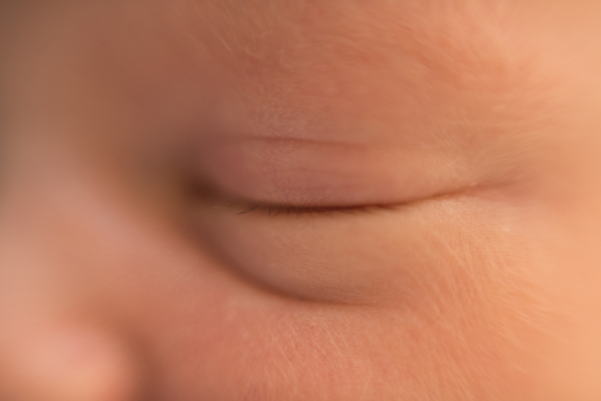 Ален 10 дней