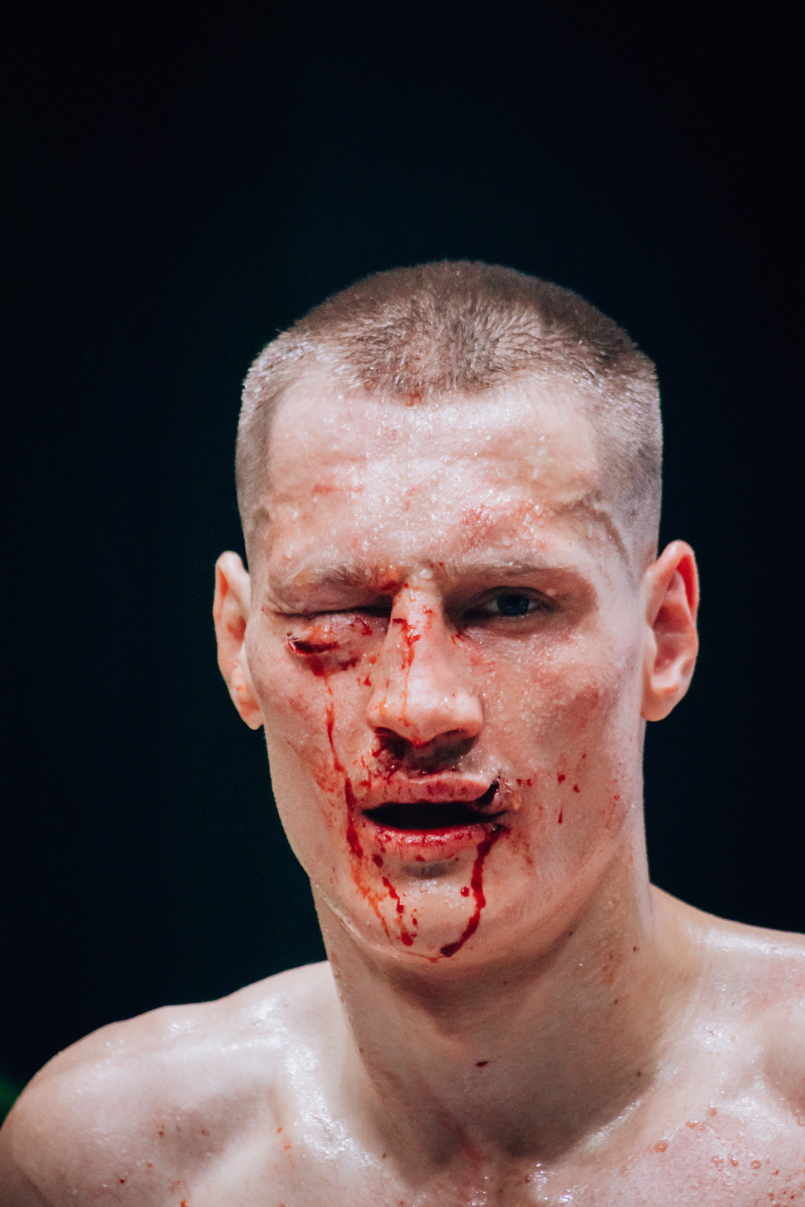 Кулачные бои TopDog. Анастасия Тен