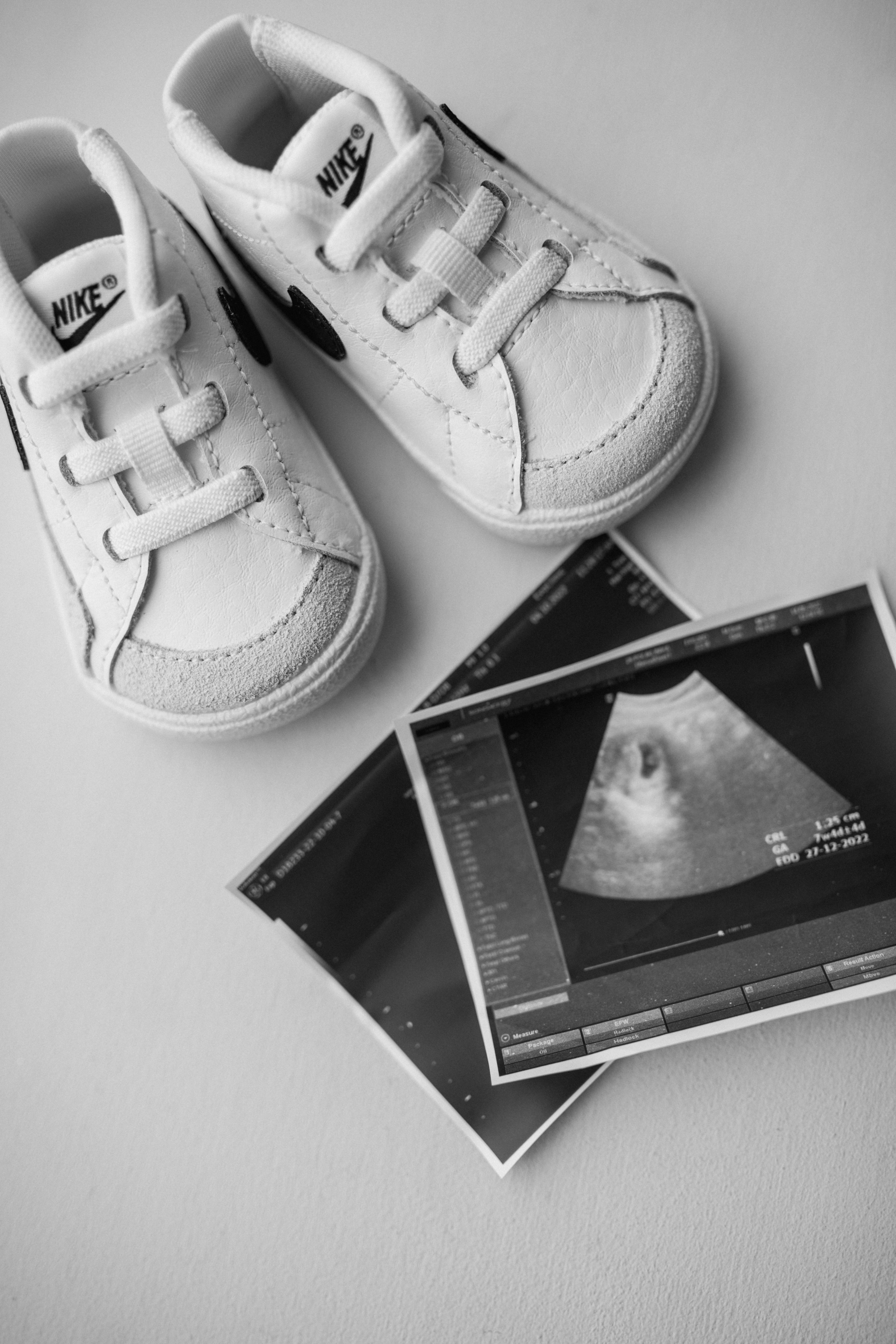 В ожидании. Polovinka.Photo — Свадебный и семейный фотограф Минск