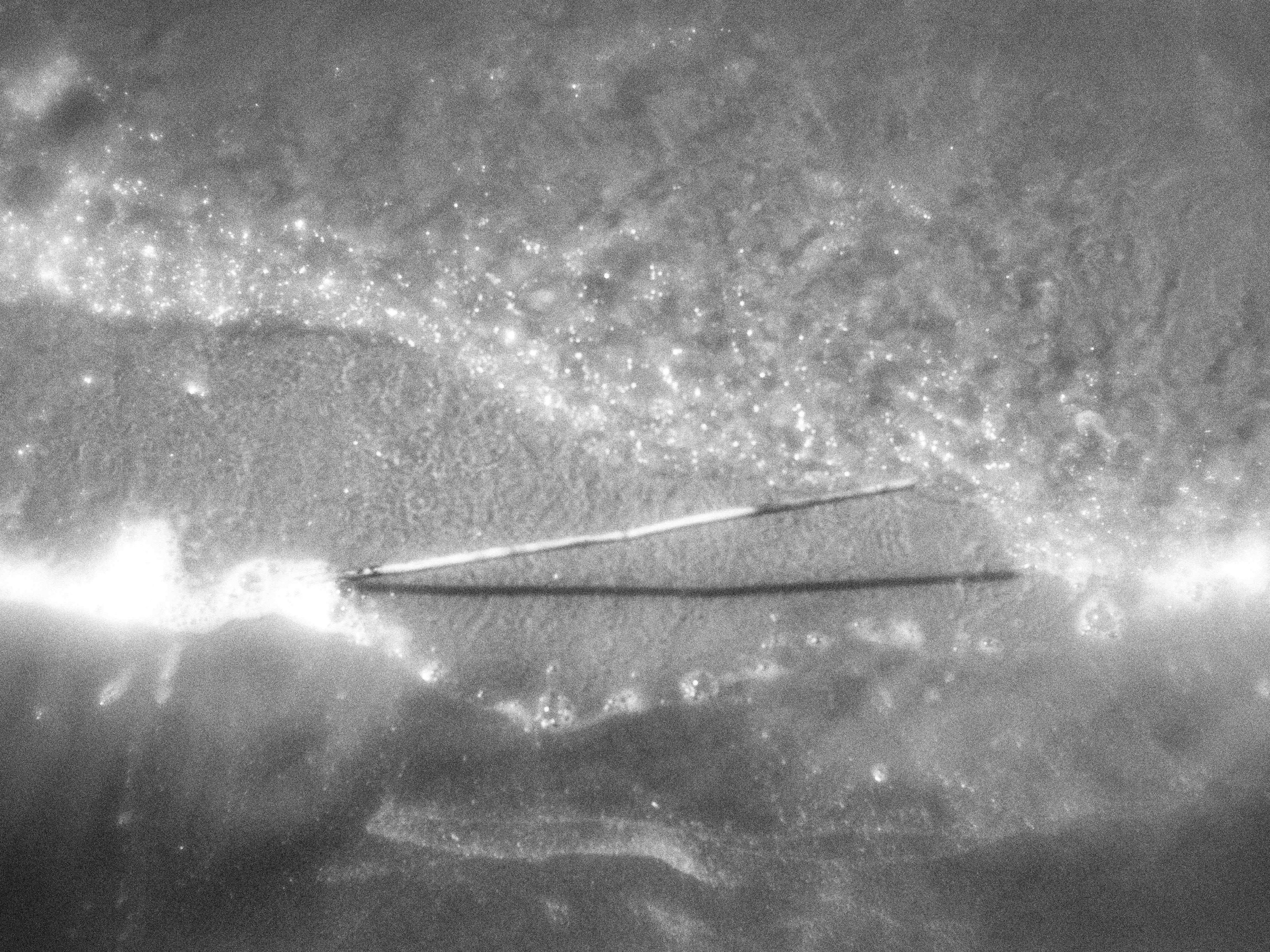 Внутривенные сны (2023)