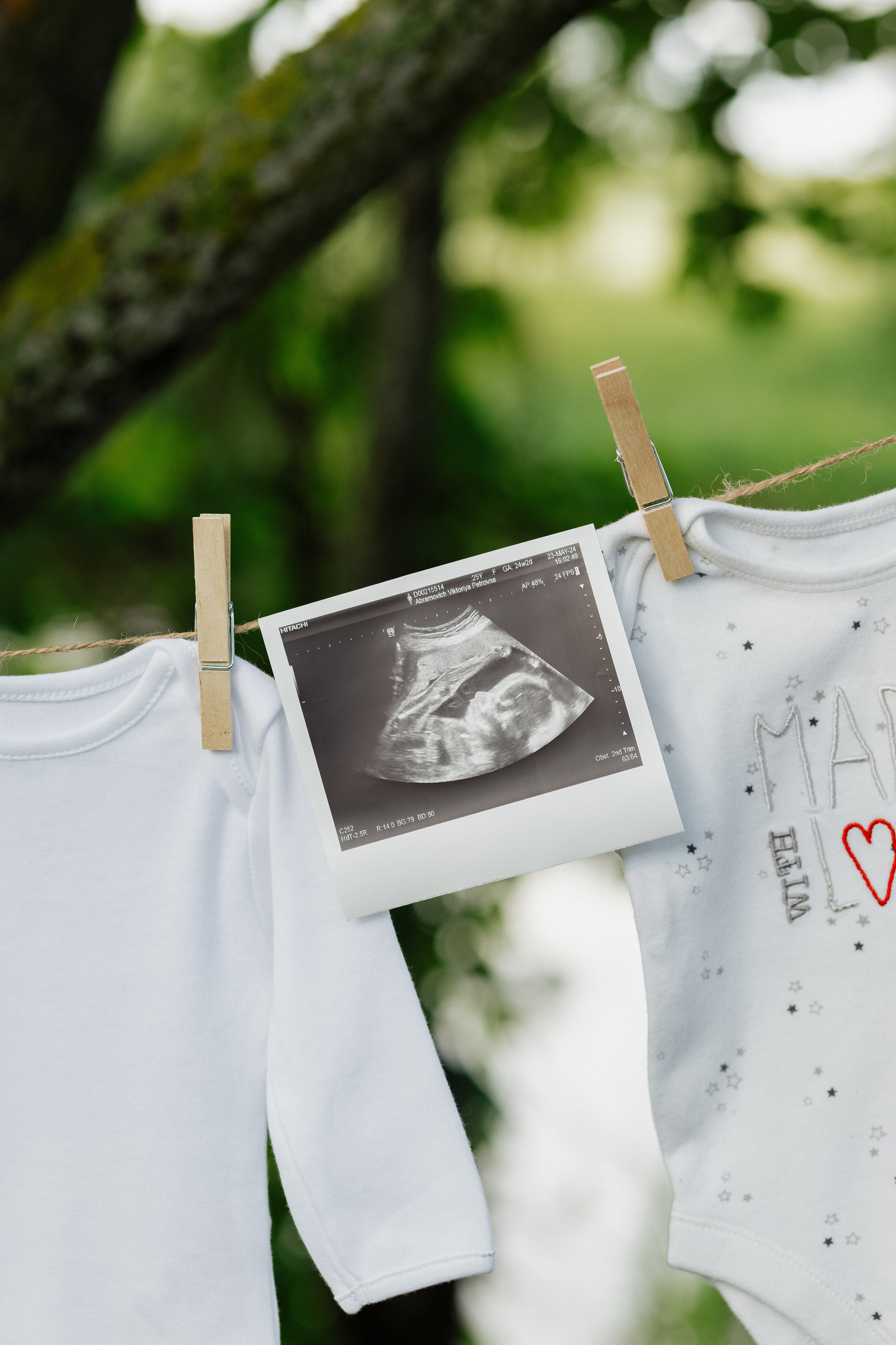 Беременность. Фотограф Минск