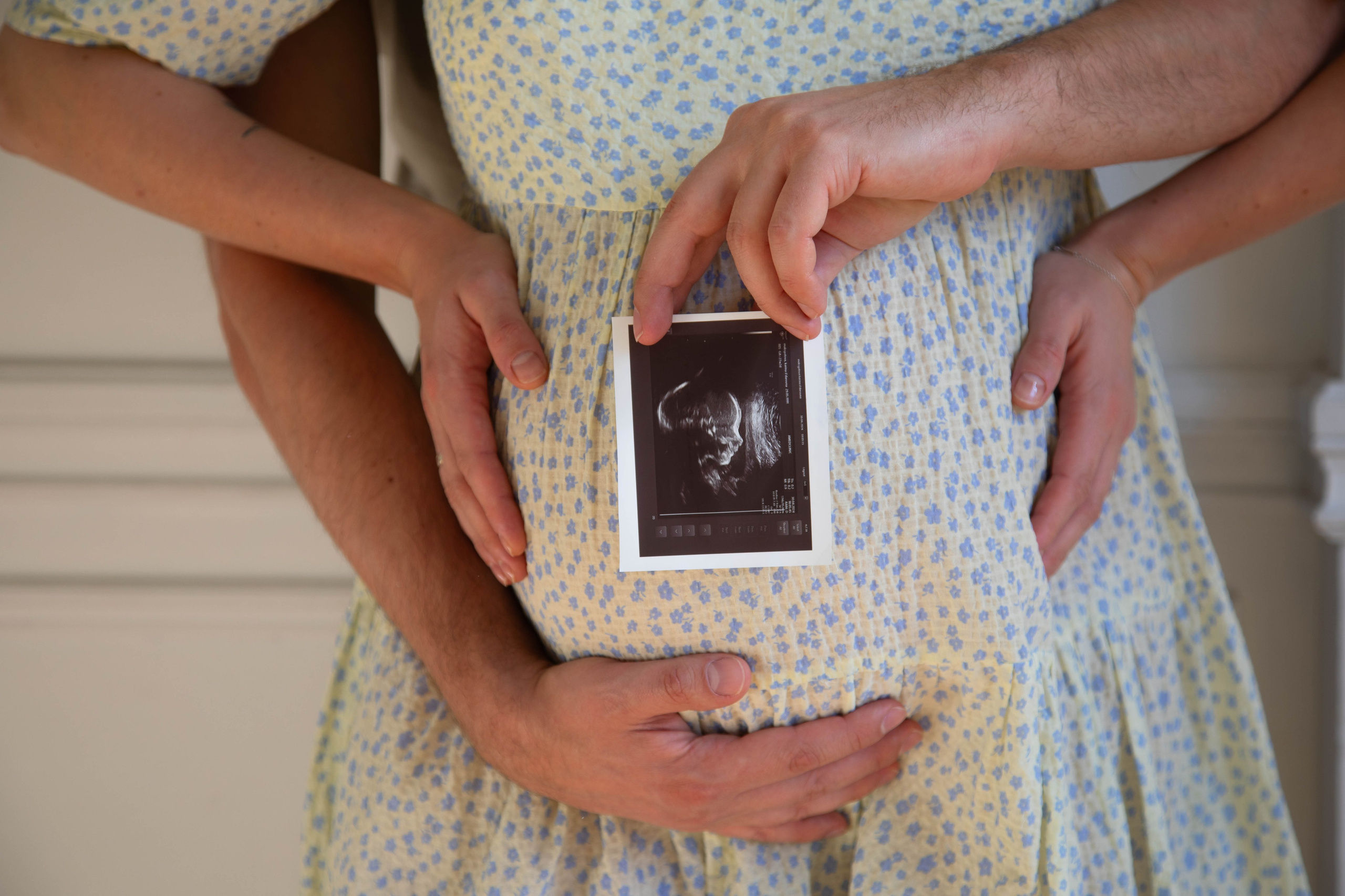 Photography by E. Kotova