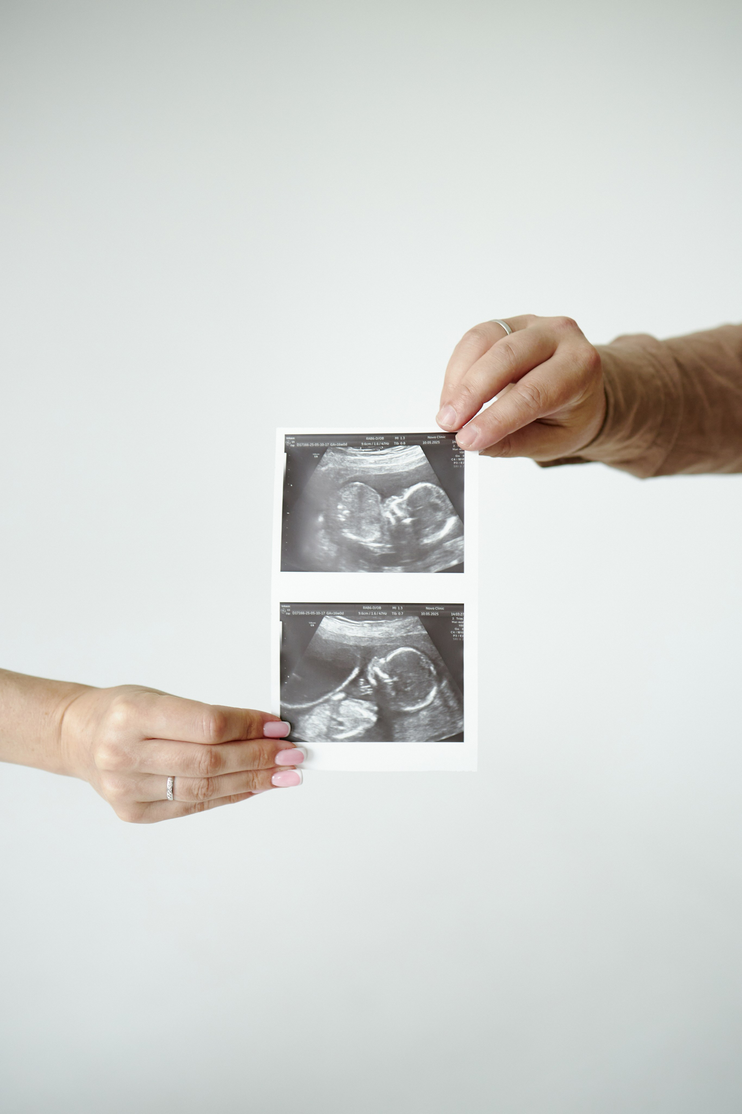 Фотосессия беременности Домодедово Москва. Свадебный семейный Фотограф в Домодедово и Москве Дарья Капитанова