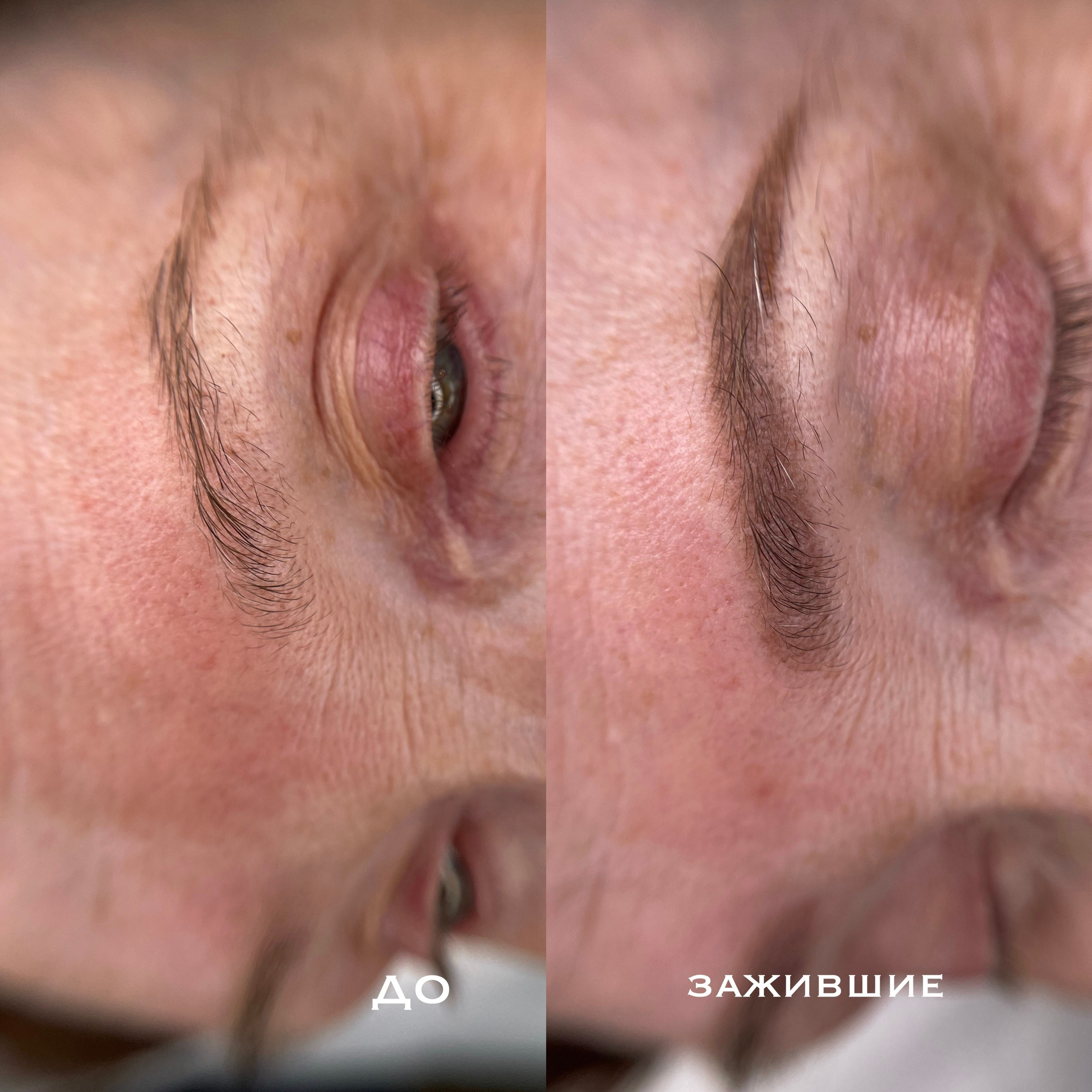 БРОВИ зажившие. Перманентный макияж и удаление старого татуажа в Ростове-на-Дону Дарья Исакова