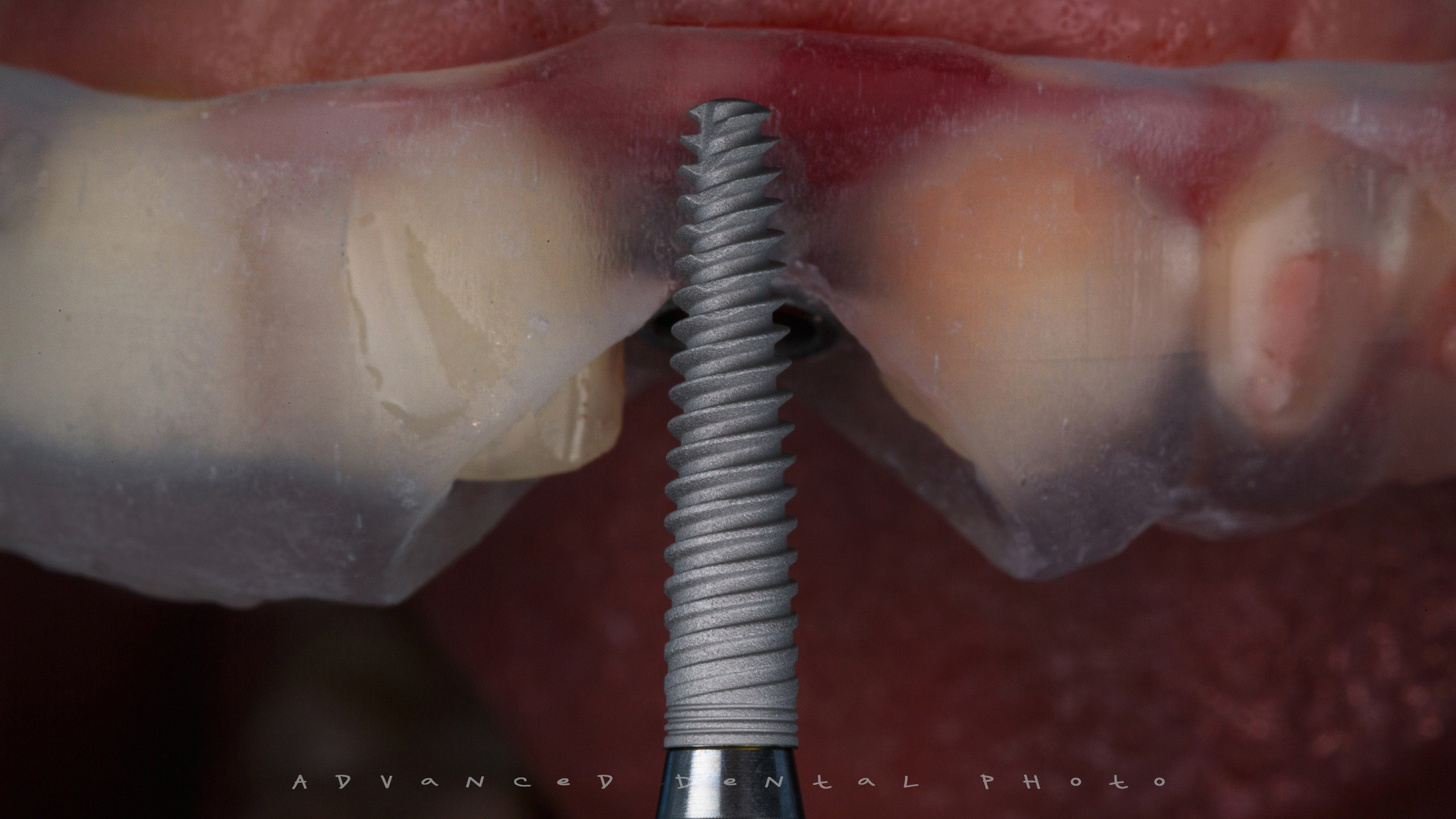 Дентал фотограф — видеограф Денис Дорошенко