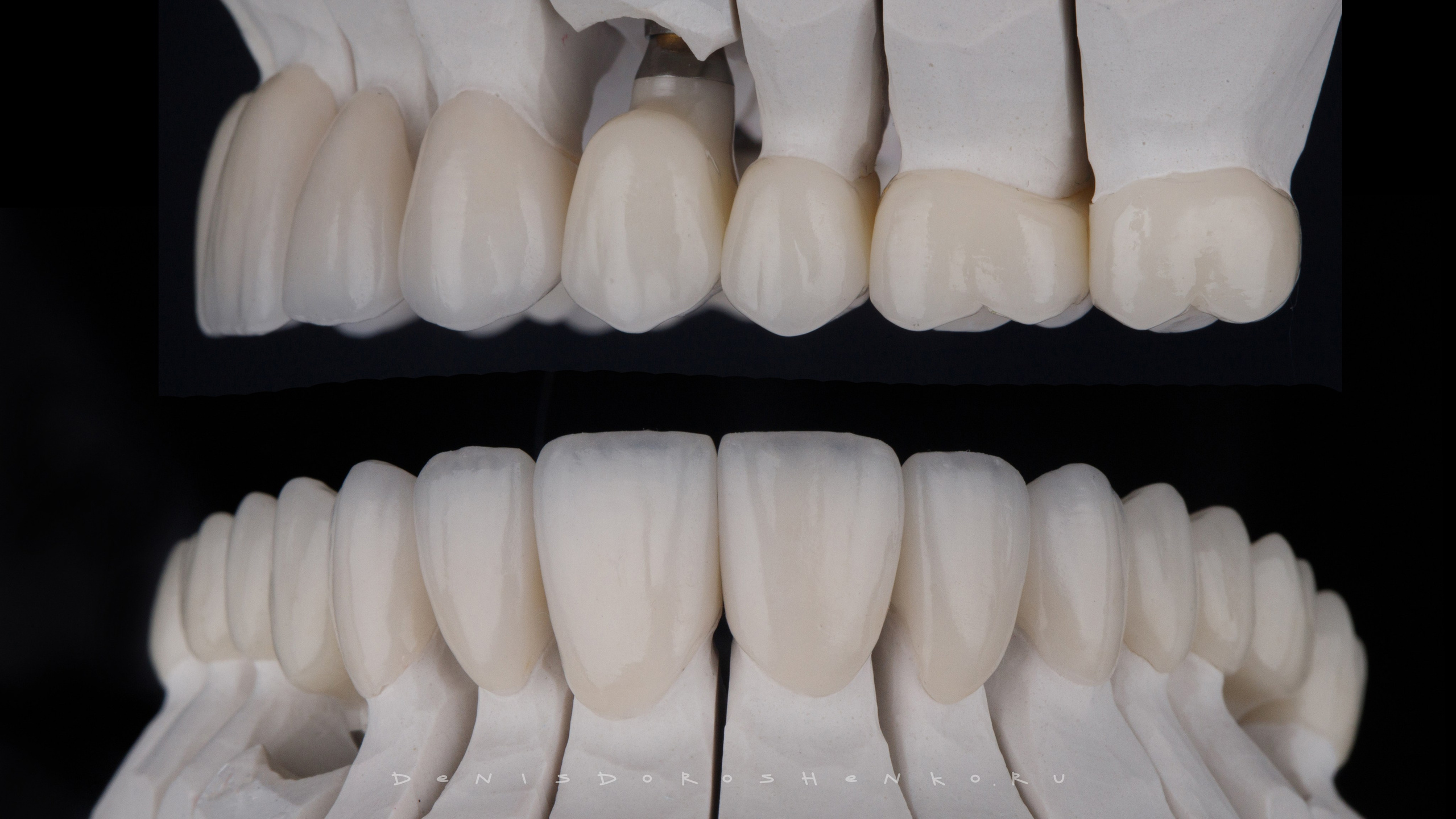 Предметная съёмка. Дентал фотограф — видеограф Денис Дорошенко