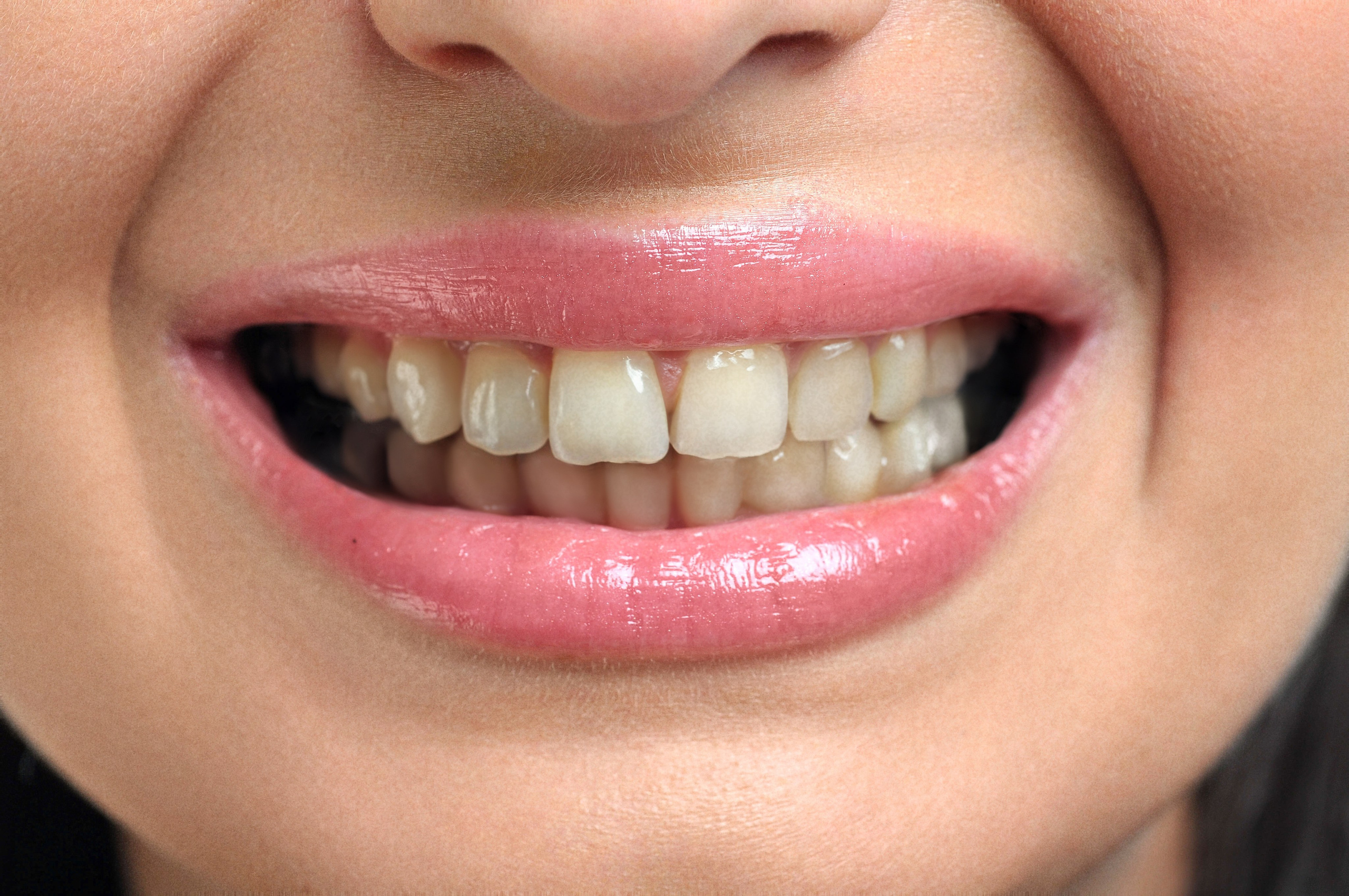 Before/after. Retusher Maryia Buhai