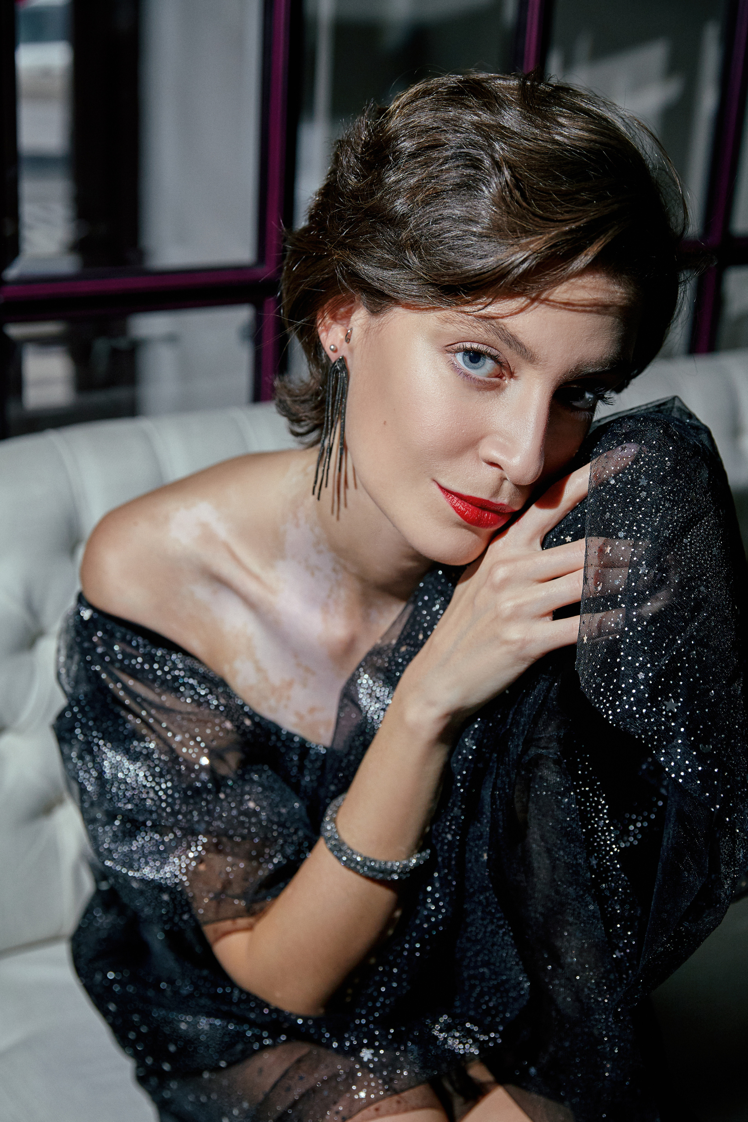 Девушка с витилиго в черном платье с блестками Atelier star people крупный портрет