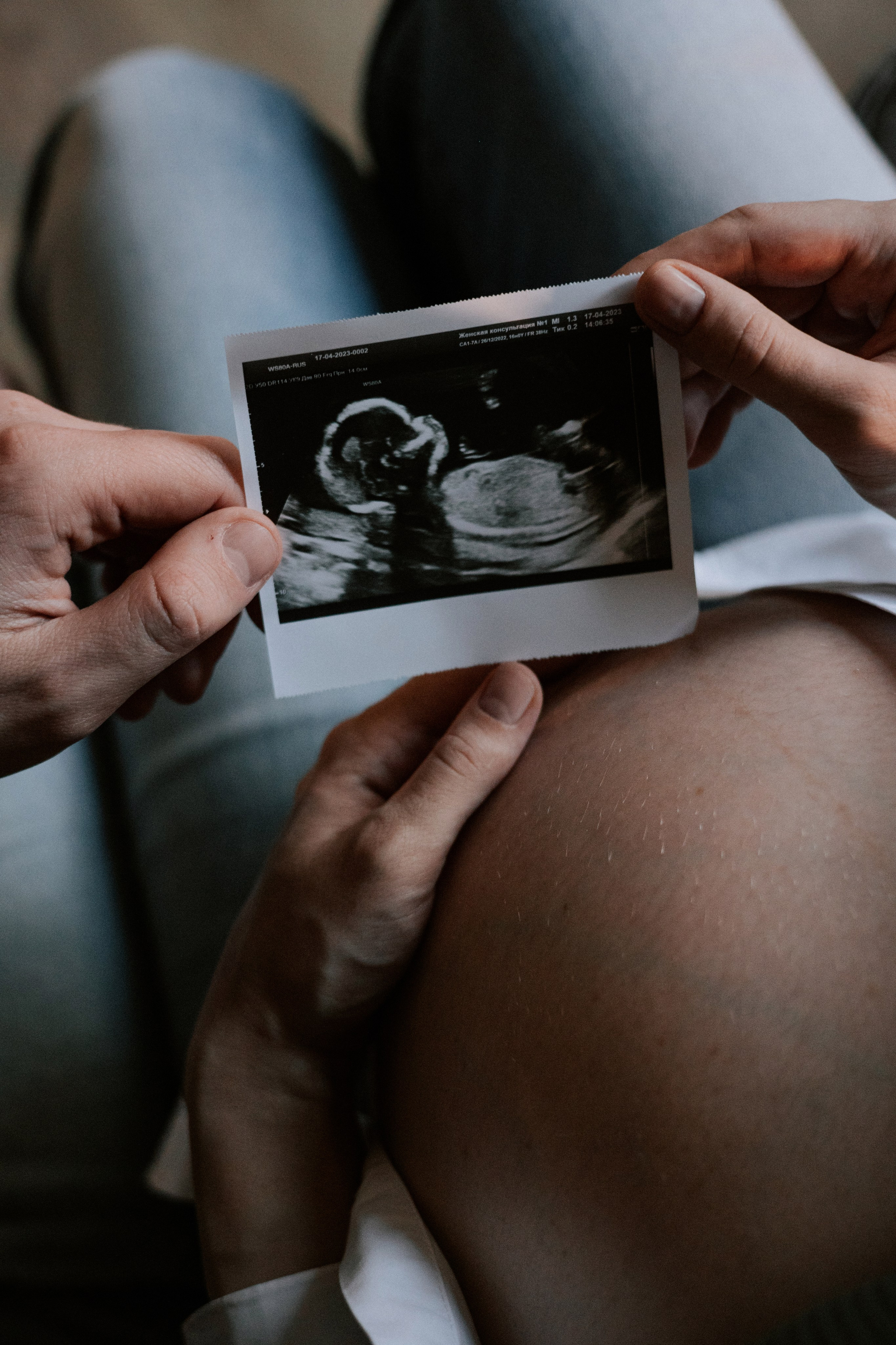 Мы ждем тебя, Мира…. ФОТОГРАФ РОЗА ФИЛИНА СПб I МОСКВА