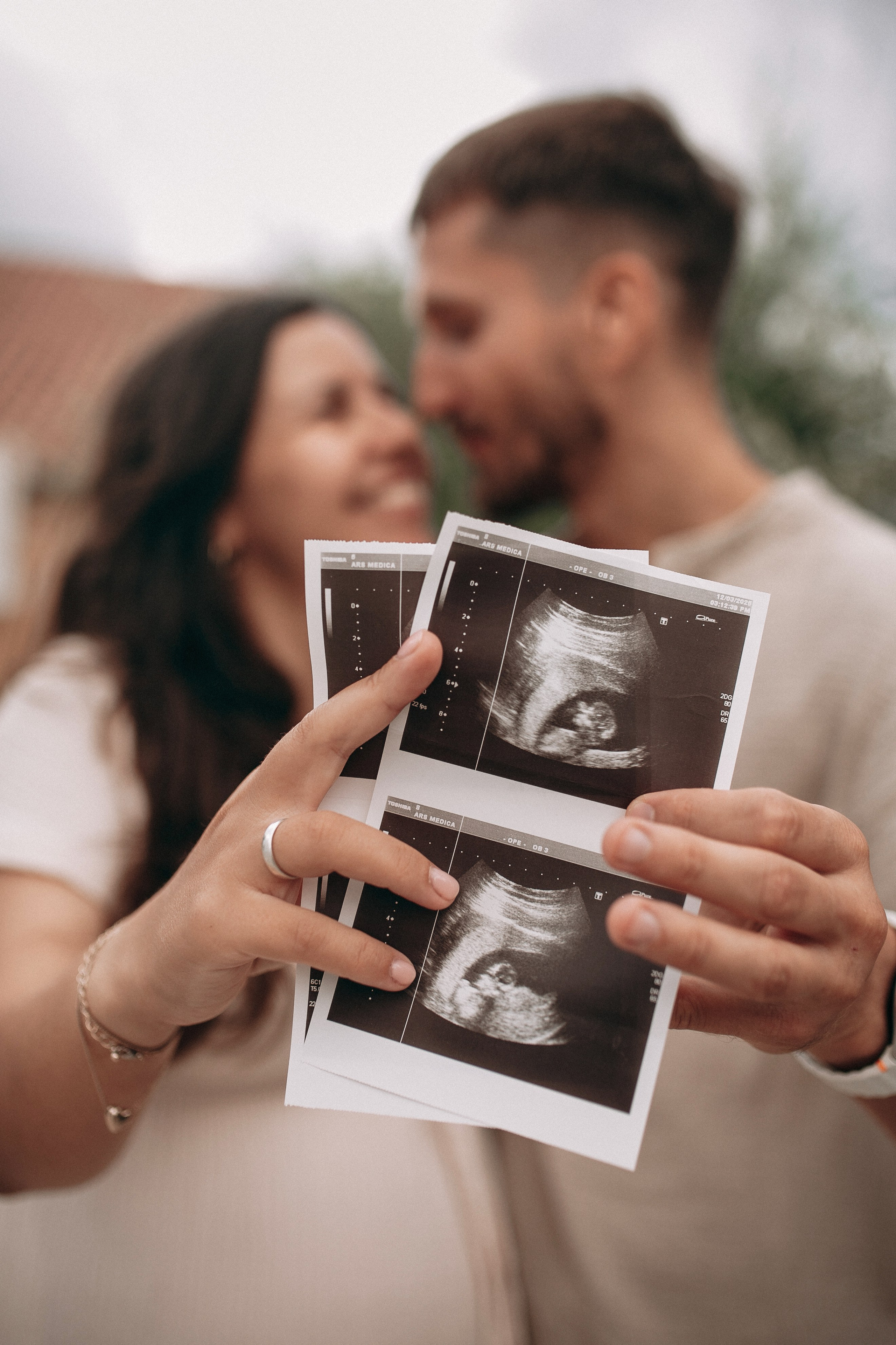 Первые снимки малыша. Родители держат в руках снимок УЗИ своего ребенка 