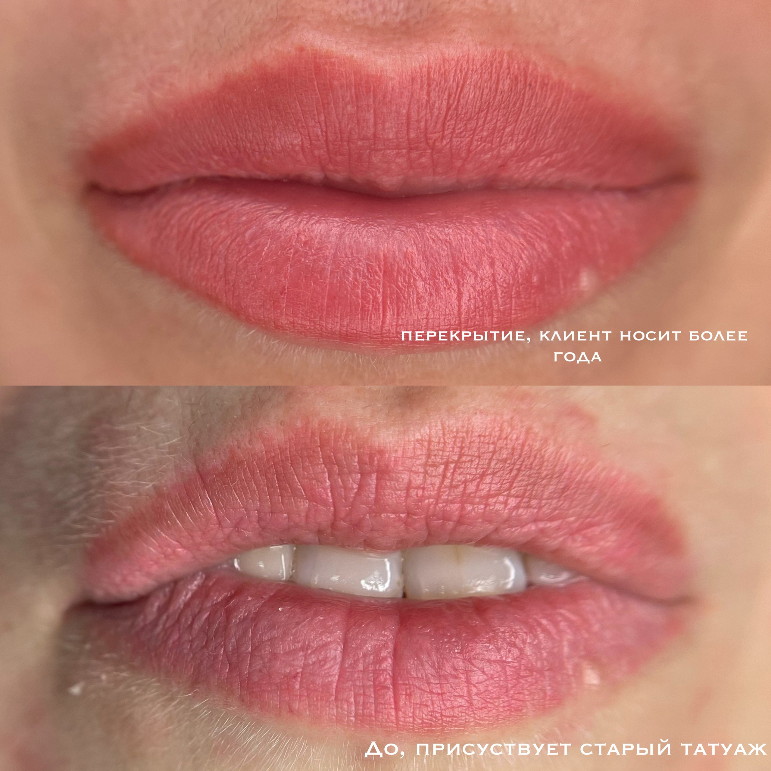 ГУБЫ зажившие. Перманентный макияж и удаление старого татуажа в Ростове-на-Дону Дарья Исакова