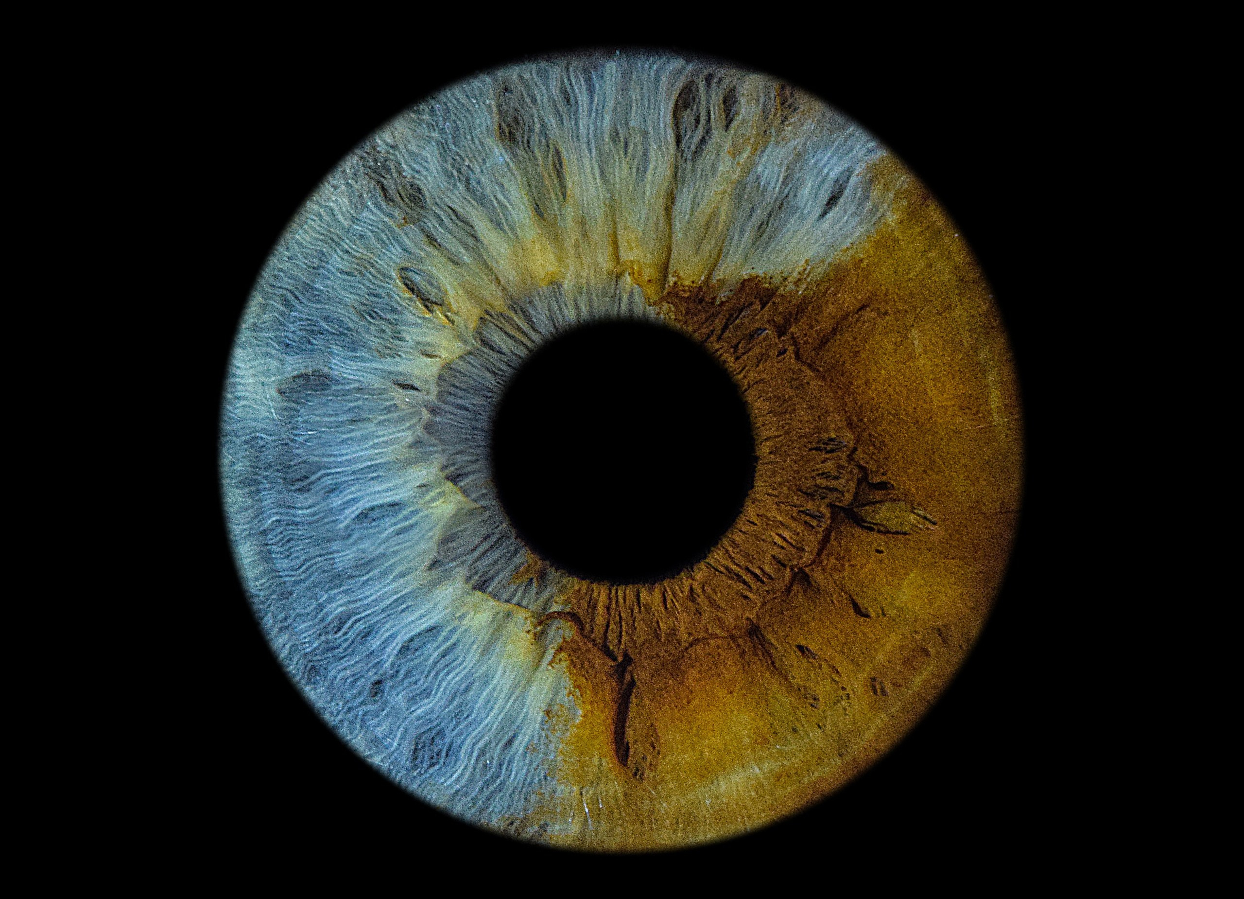 Портфолио. EYEtob | Фотография радужной оболочки | Тобольск