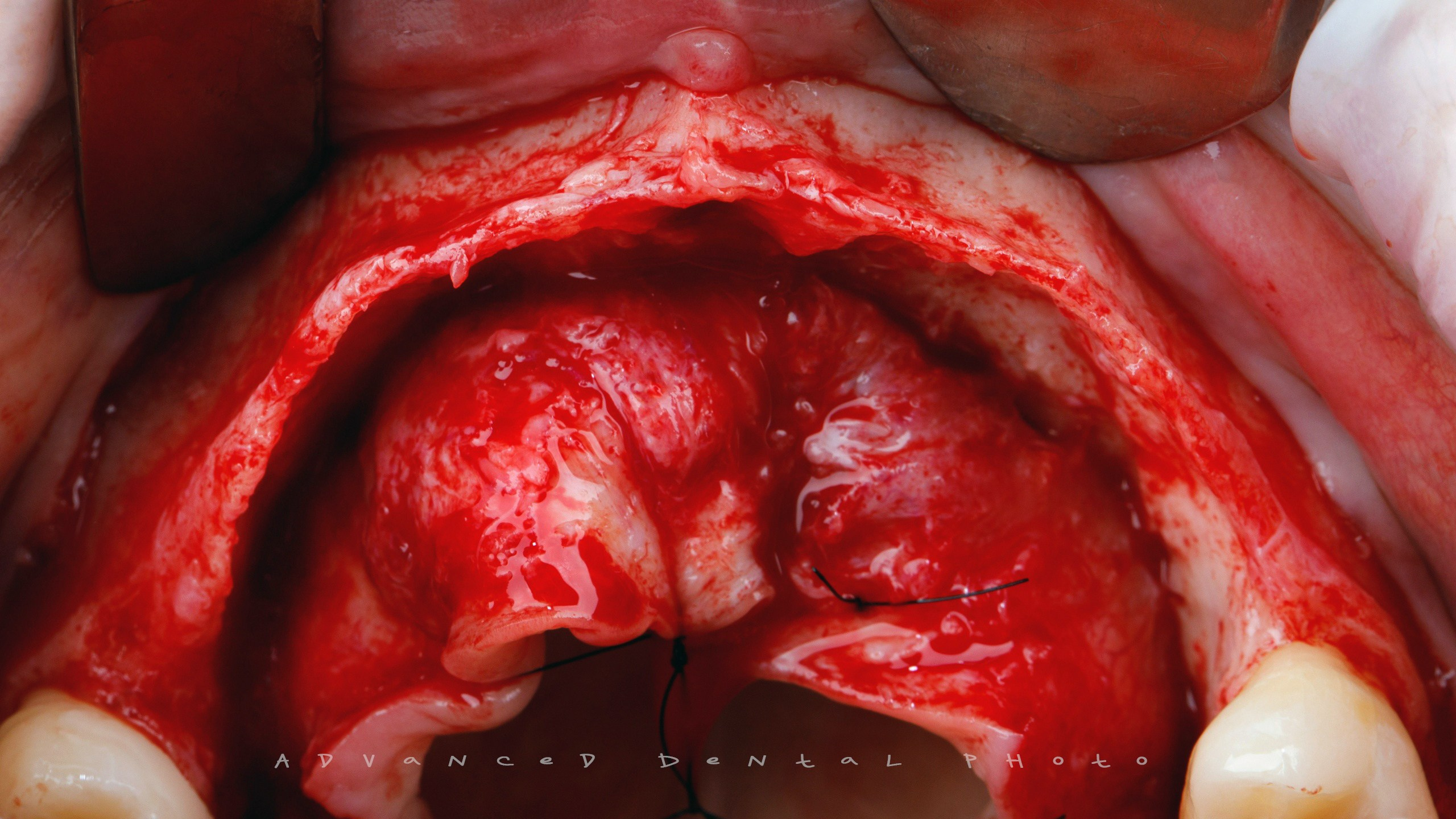 Хирургия. Дентал фотограф — видеограф Денис Дорошенко